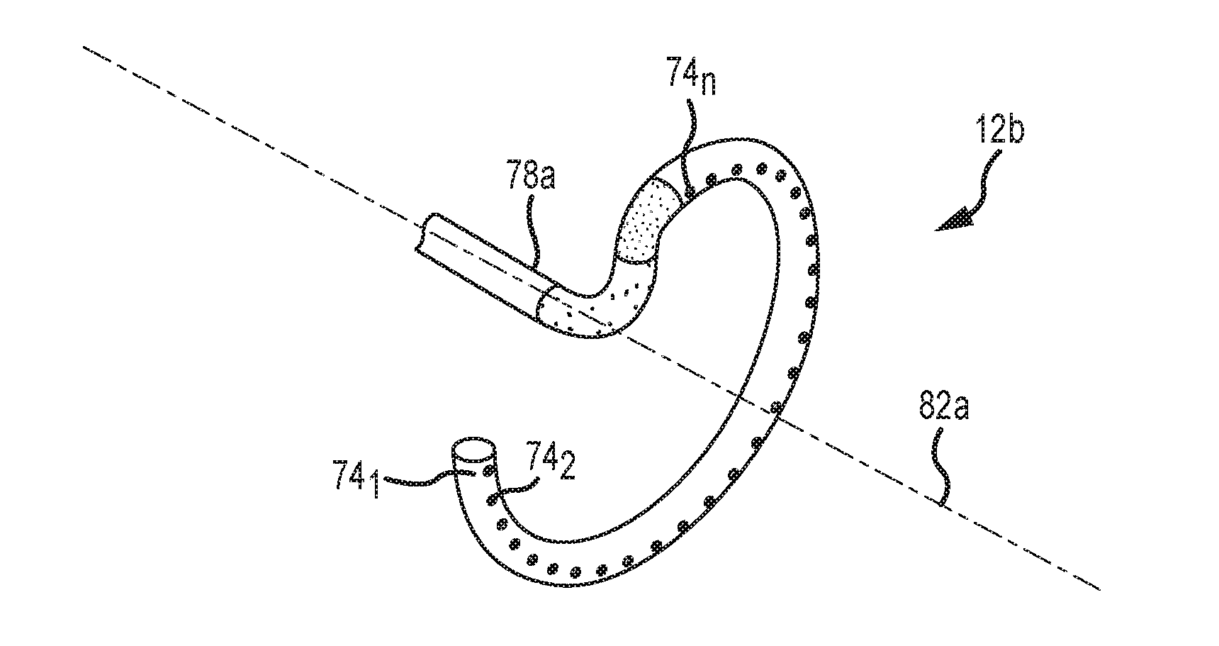 Catheter systems