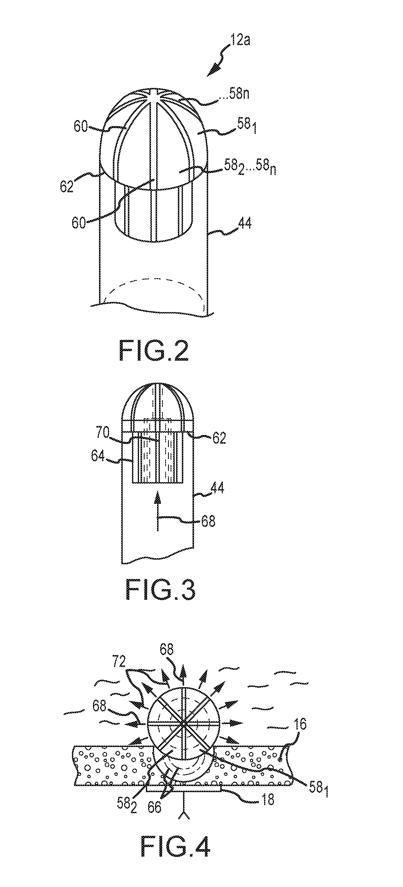 Catheter systems