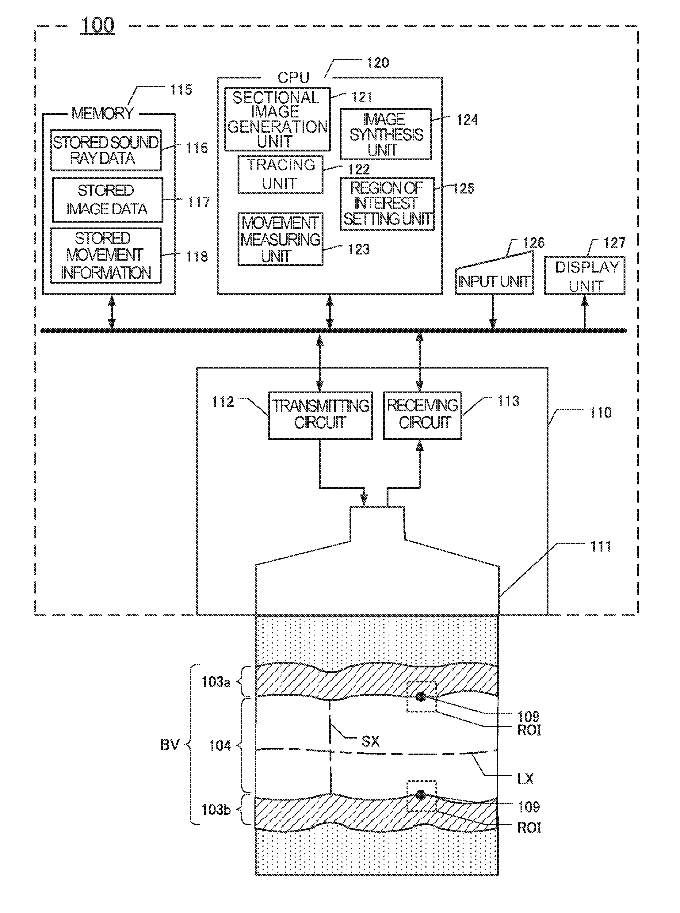 Ultrasound diagnostic apparatus and method for tracing movement of tissue