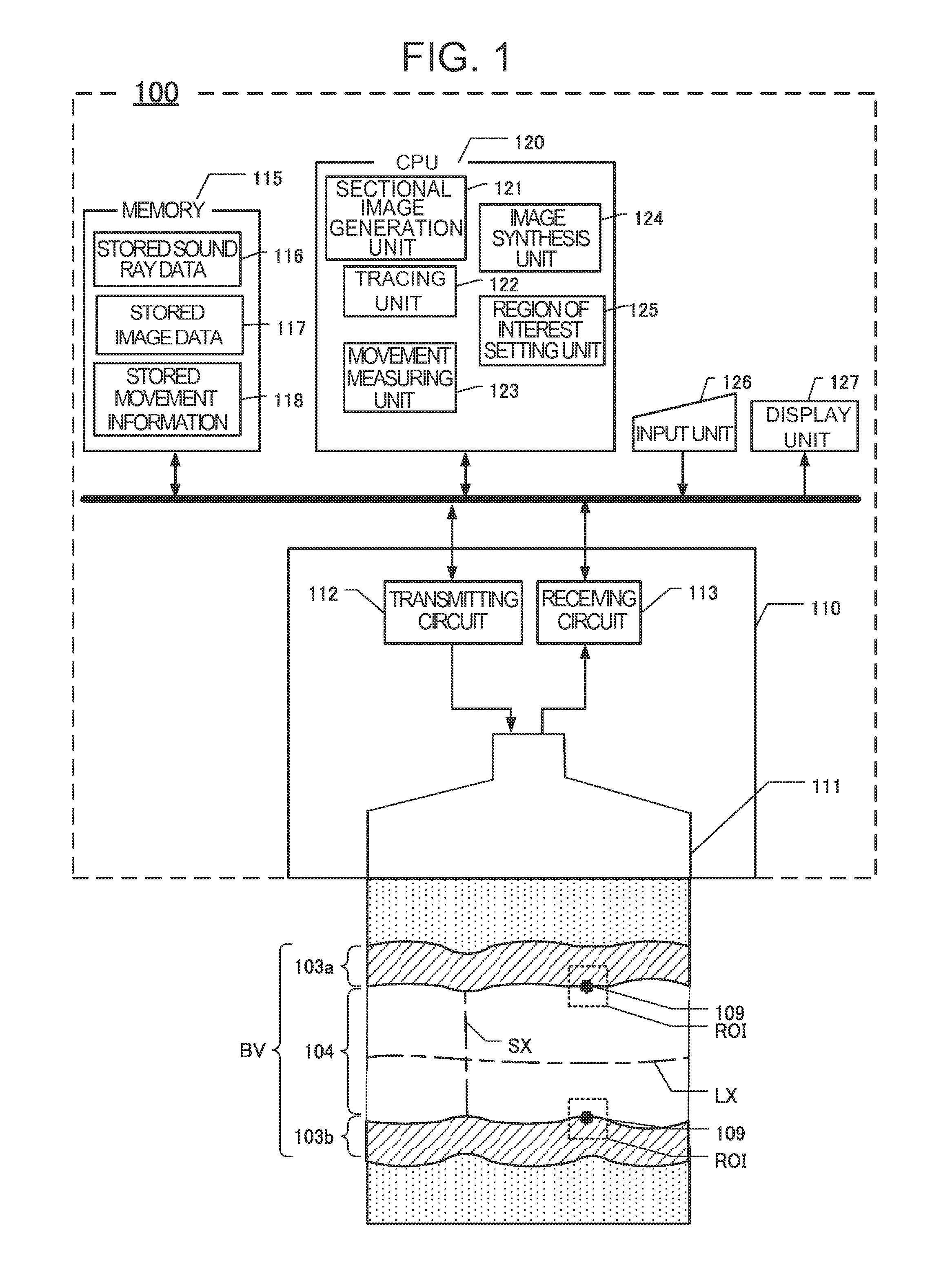 Ultrasound diagnostic apparatus and method for tracing movement of tissue