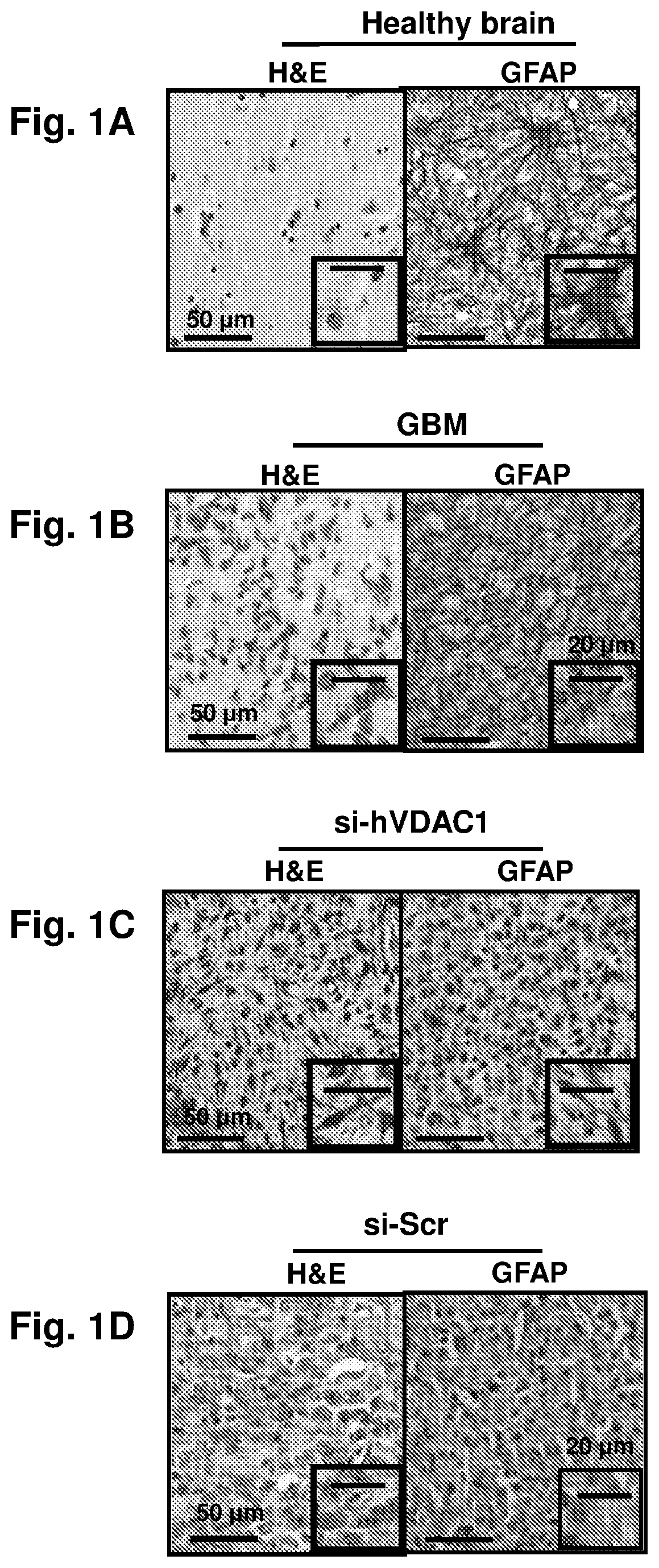 Means and methods for reducing tumorigenicity of cancer stem cells