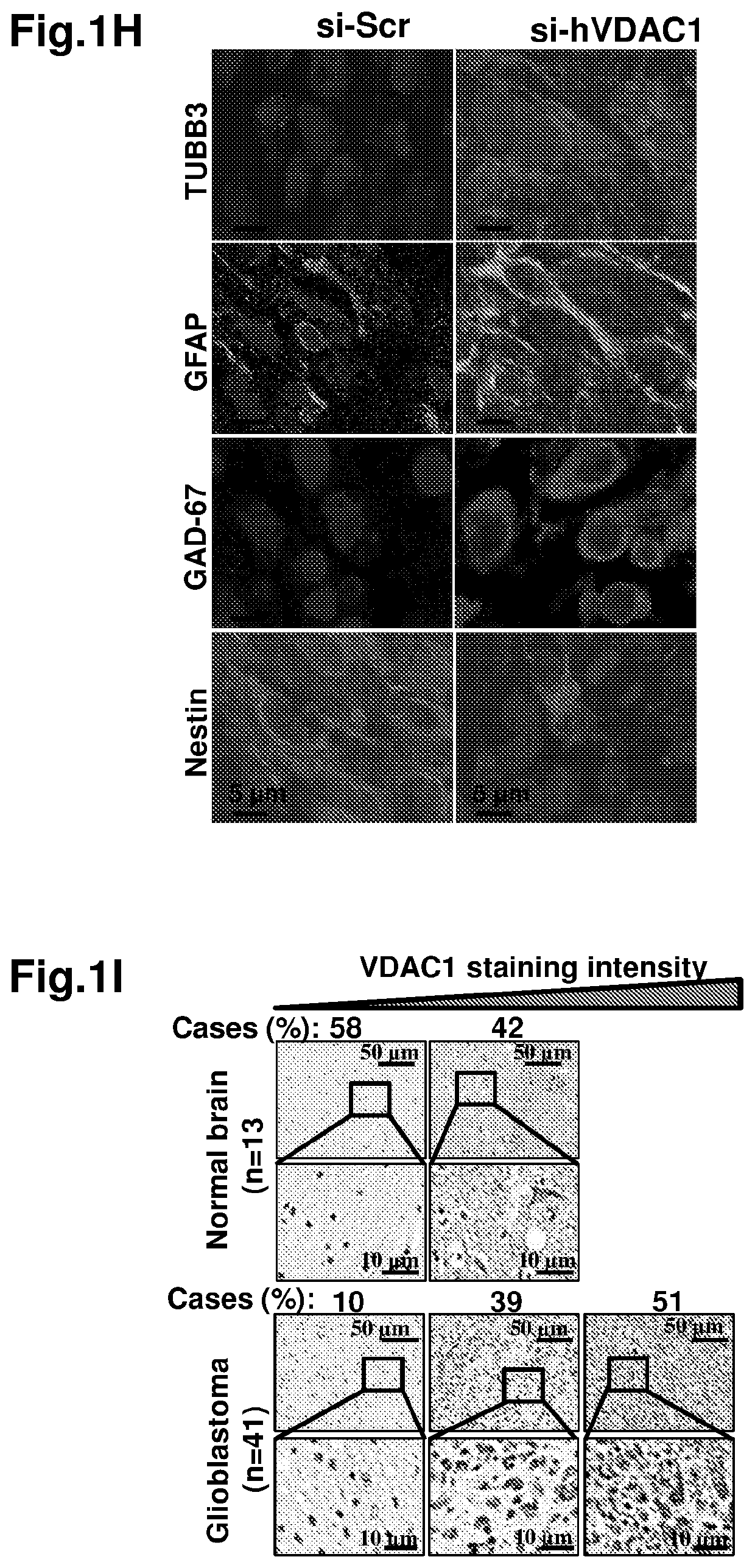 Means and methods for reducing tumorigenicity of cancer stem cells