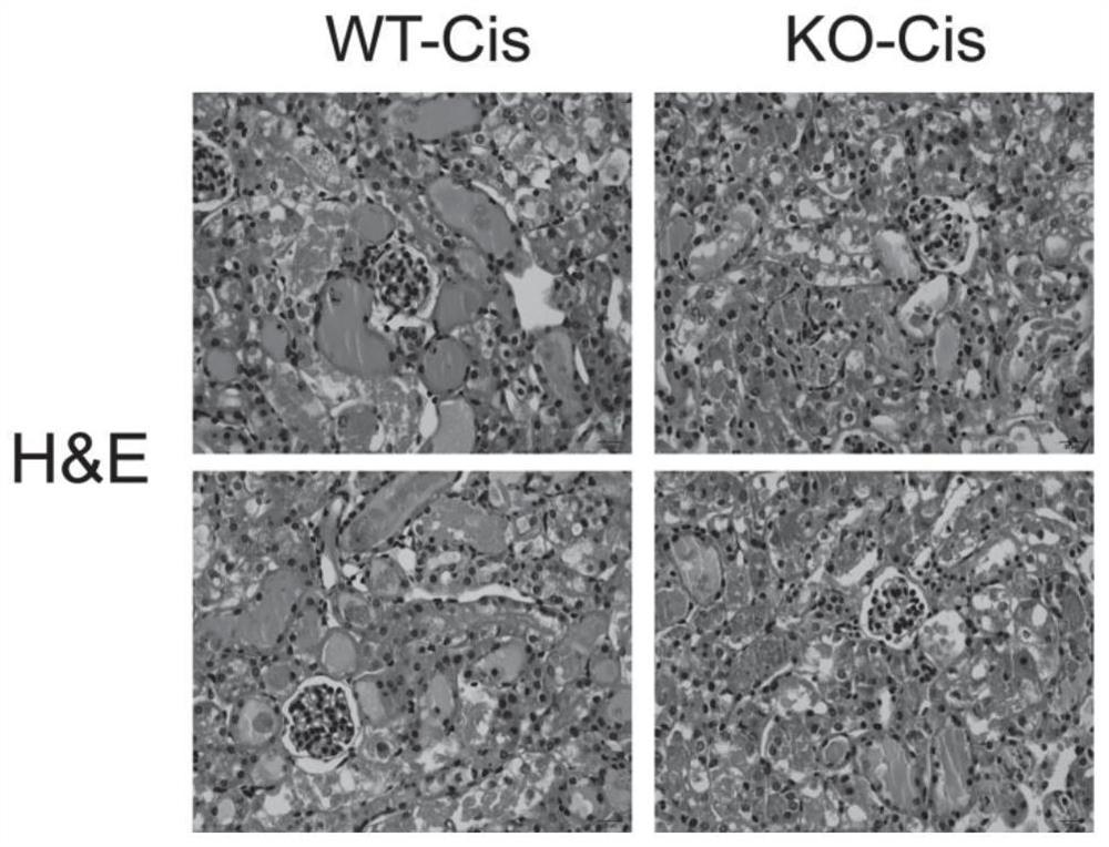 Application of mPGES-2 as drug target for preventing and/or treating kidney diseases