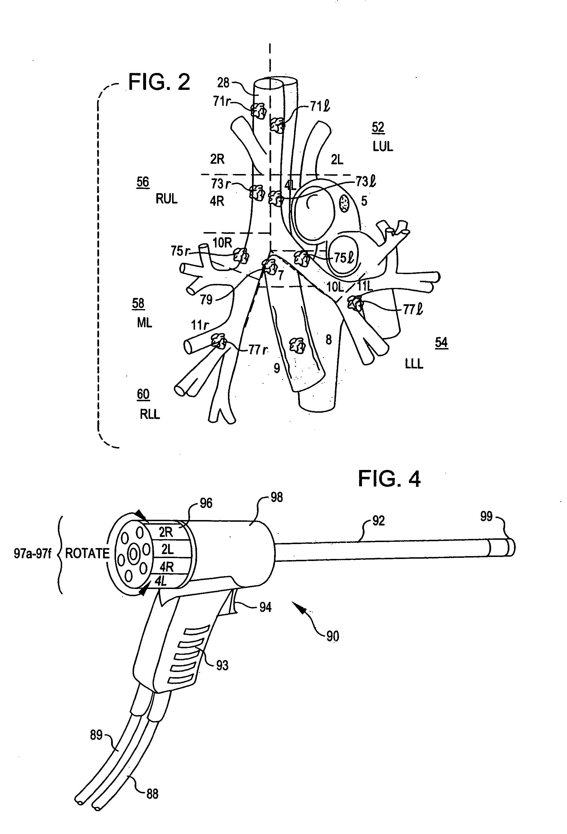 Apparatus and method for resecting and removing selected body tissue from a site inside a patient