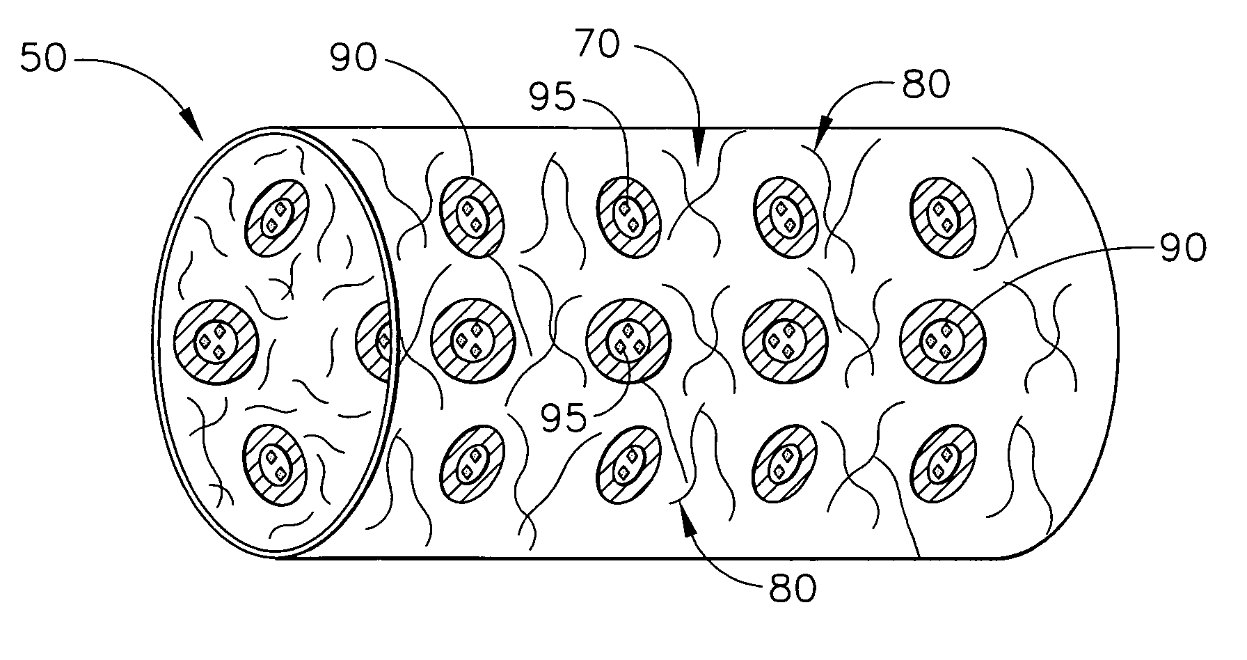 Biodegradable vascular device with buffering agent