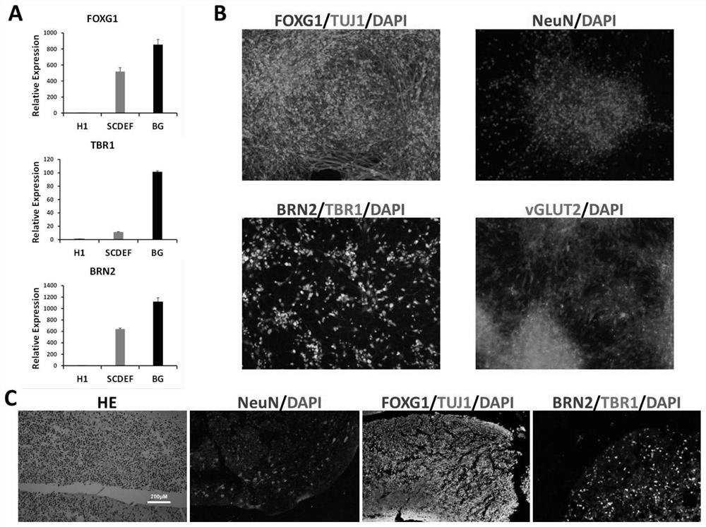 In-vitro induction and long-term culture system, induced culture method and application of forebrain neural stem cells