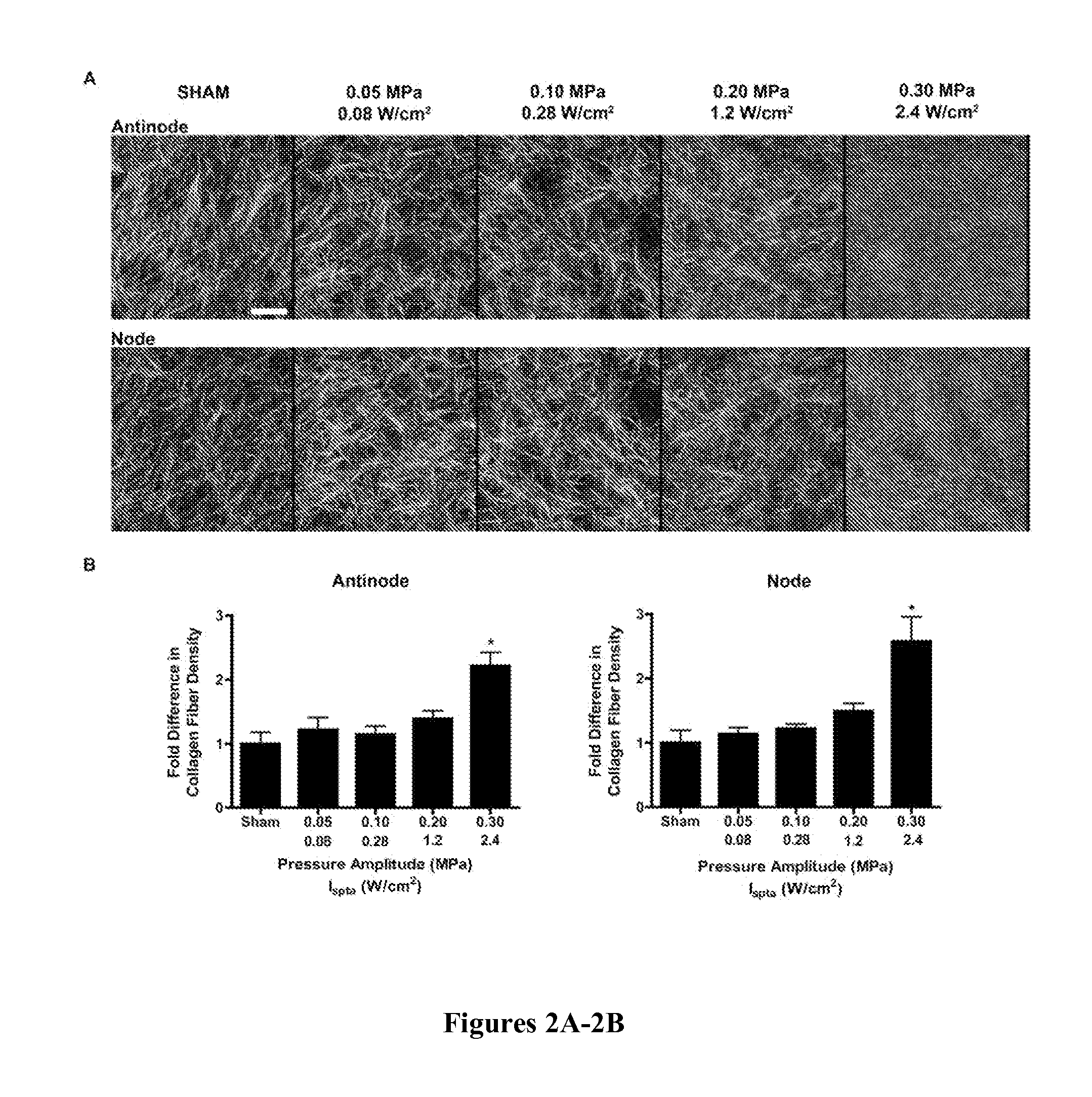 Controlling extracellular matrix protein microstructure with ultrasound