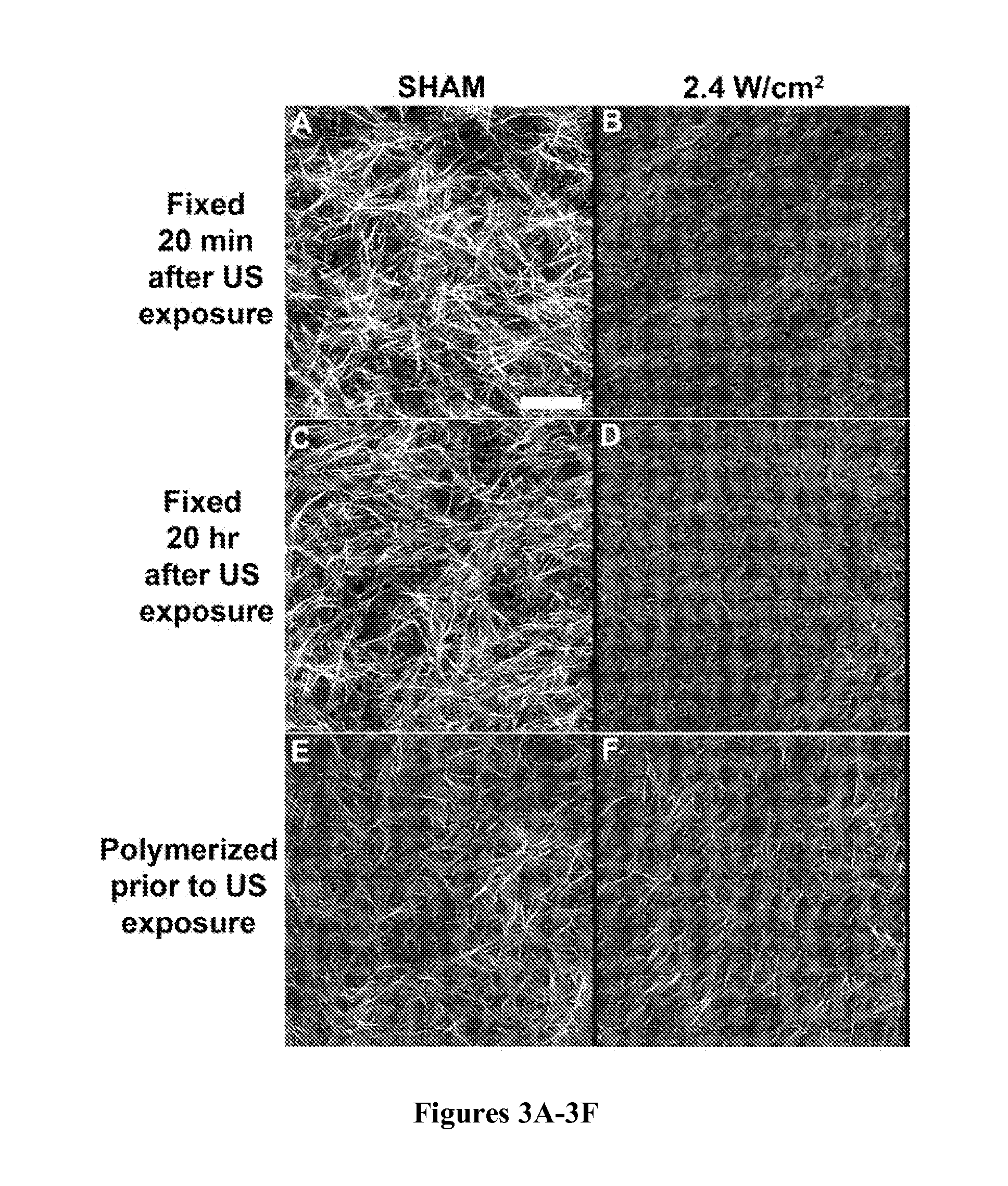 Controlling extracellular matrix protein microstructure with ultrasound