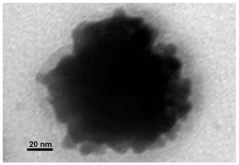 A preparation method of sea urchin-shaped gold nanoparticles and its application in tumor imaging and treatment
