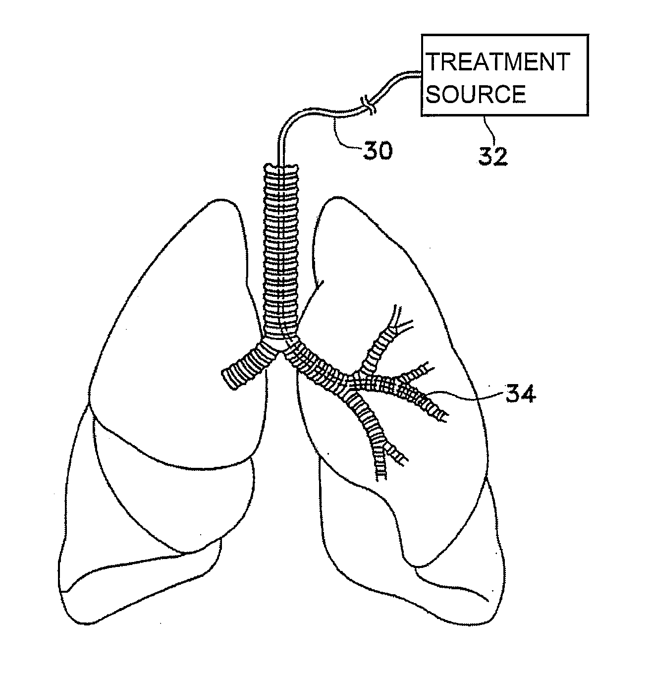 Methods of reducing mucus in airways