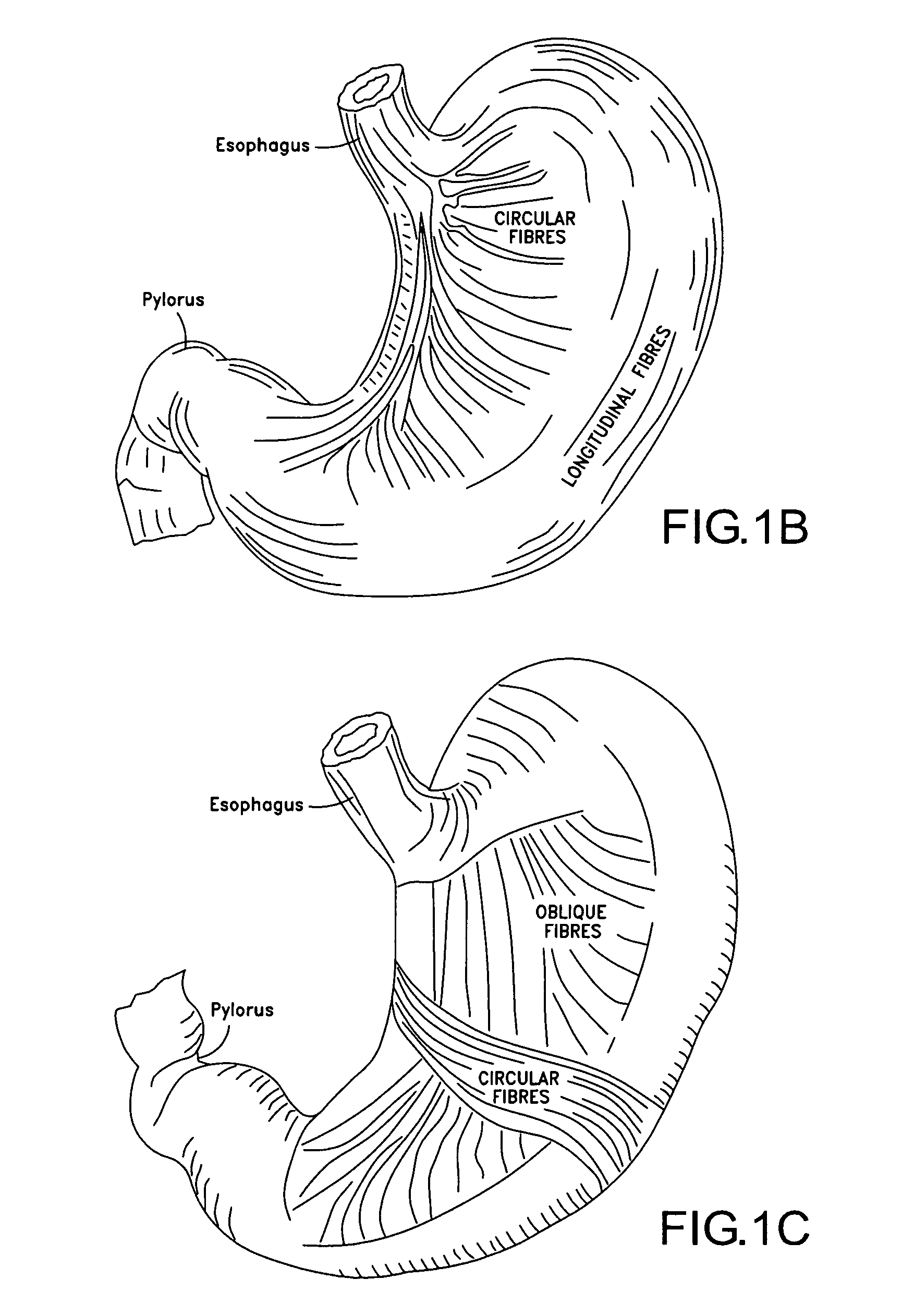 Apparatus and method for treating obesity using neurotoxins in conjunction with bariatric procedures