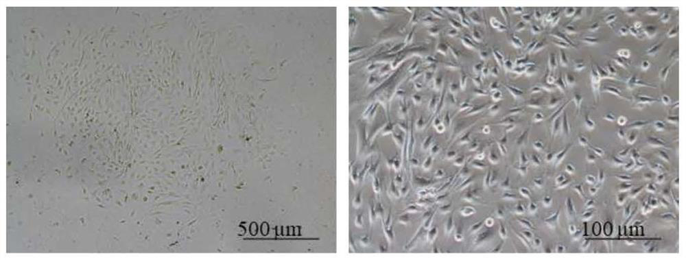 Preparation method of human adult cardiac mesenchymal-like stem cells