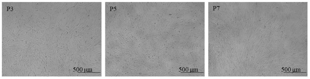 Preparation method of human adult cardiac mesenchymal-like stem cells