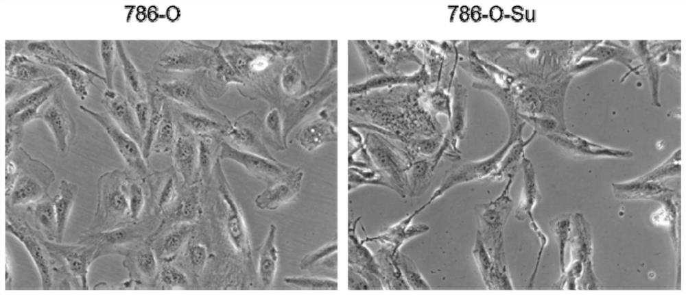 A sunitinib-resistant cell line of renal cancer, its construction method and its application