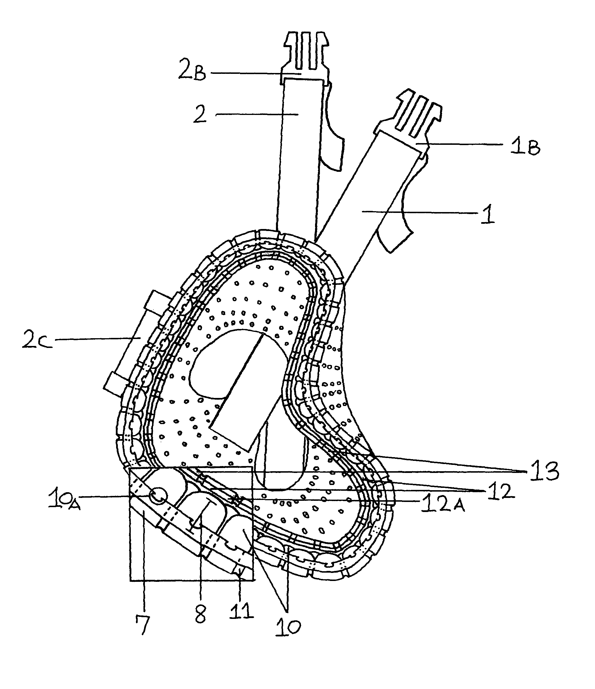 Device to treat and/or prevent shoulder subluxation