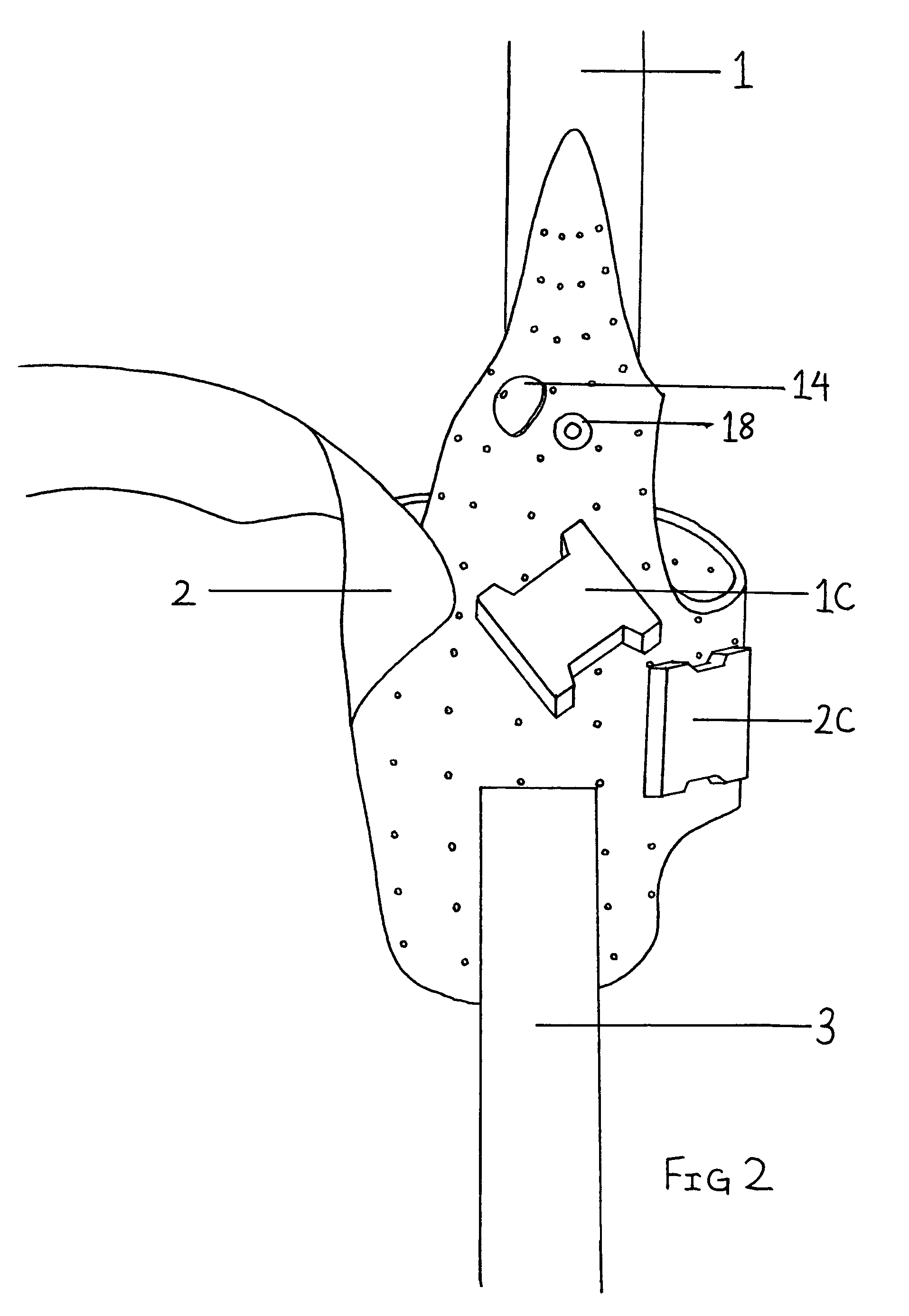 Device to treat and/or prevent shoulder subluxation