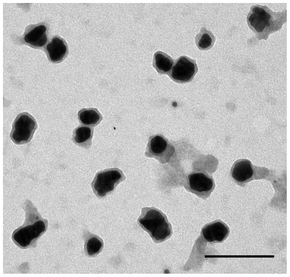 Tumor cell nano-gold vesicles, immune nano-gold vesicles, preparation method and application
