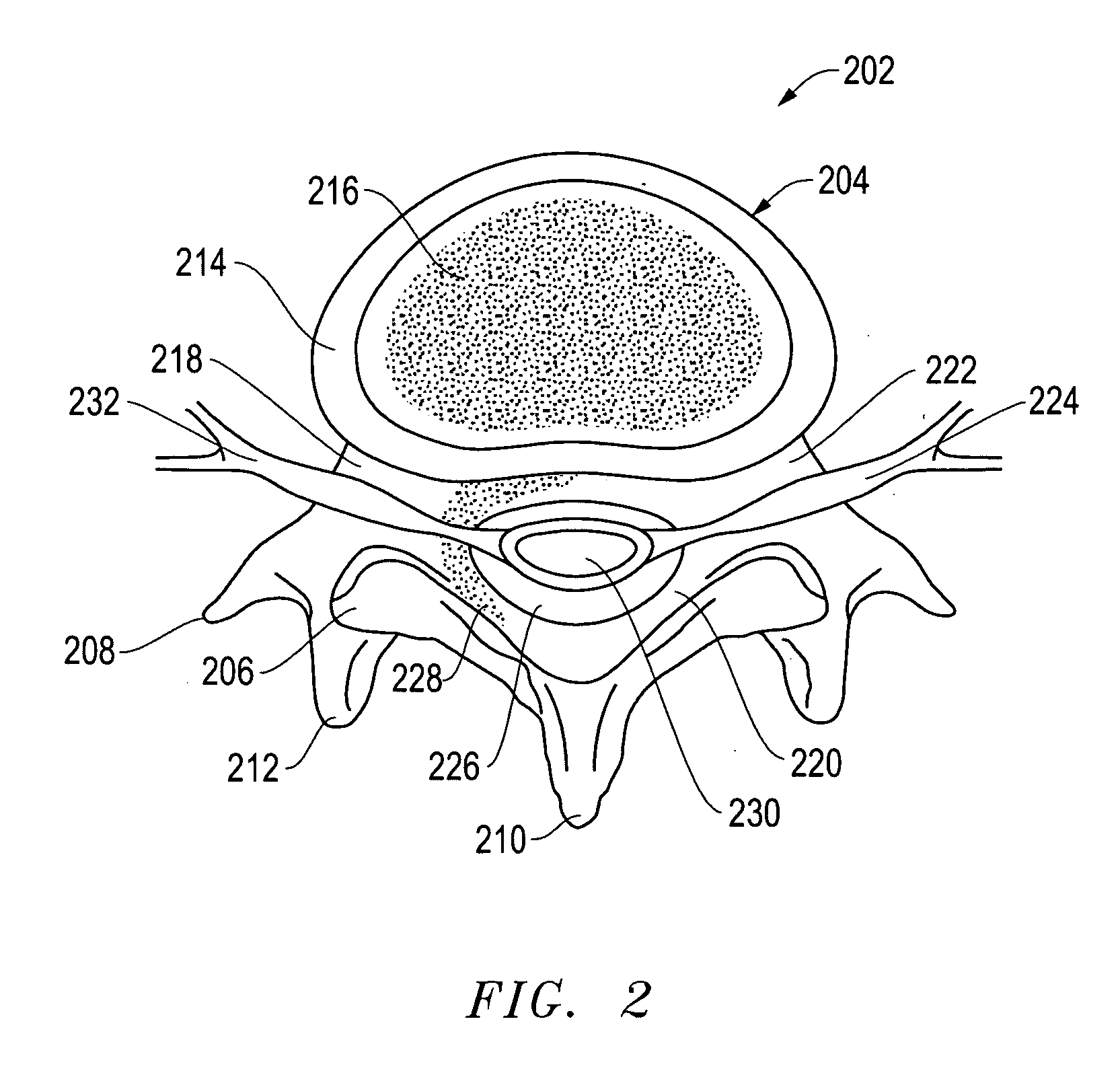 Tool for Finishing the Ends of Surgical Rods and Methods of Use