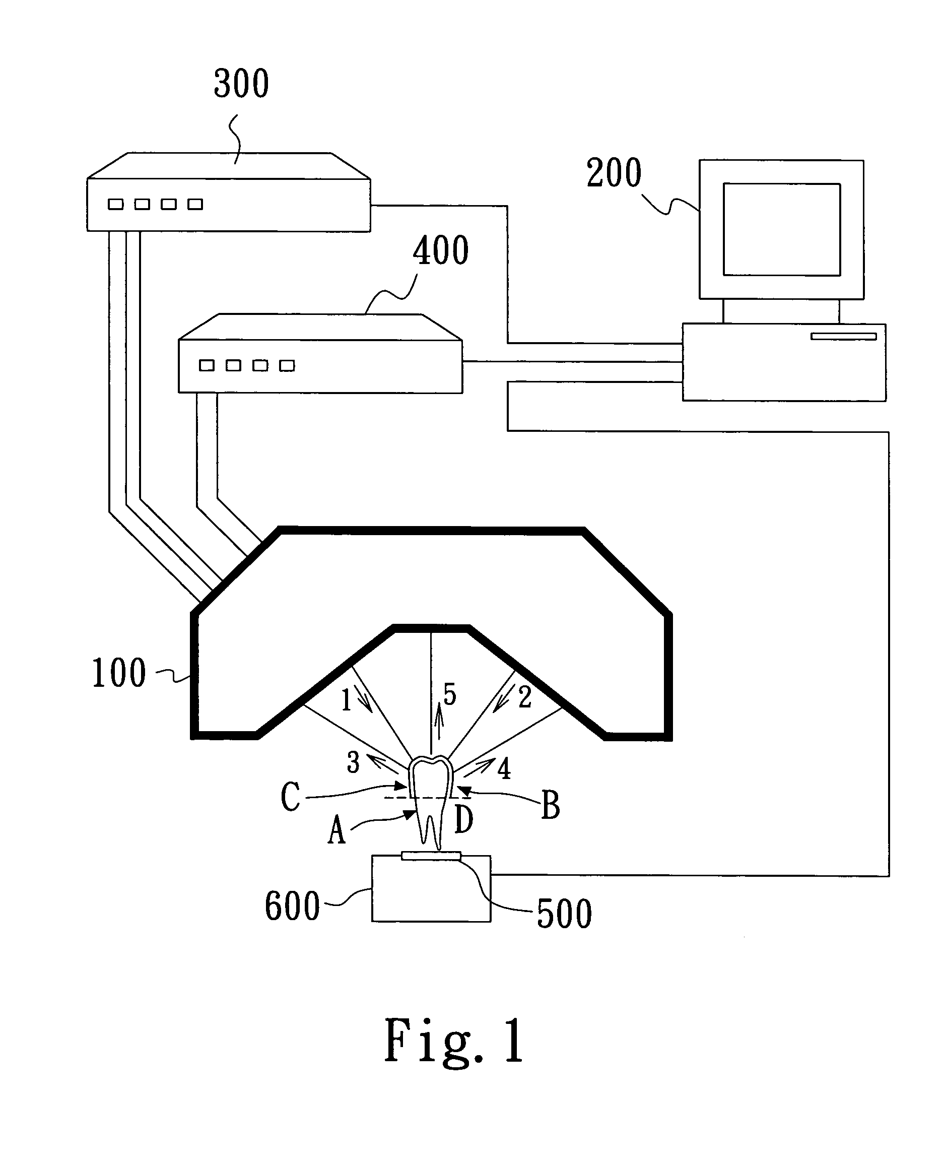 Apparatus and method for rapid and precise scanning of three-dimensional occlusal profile of dental cast