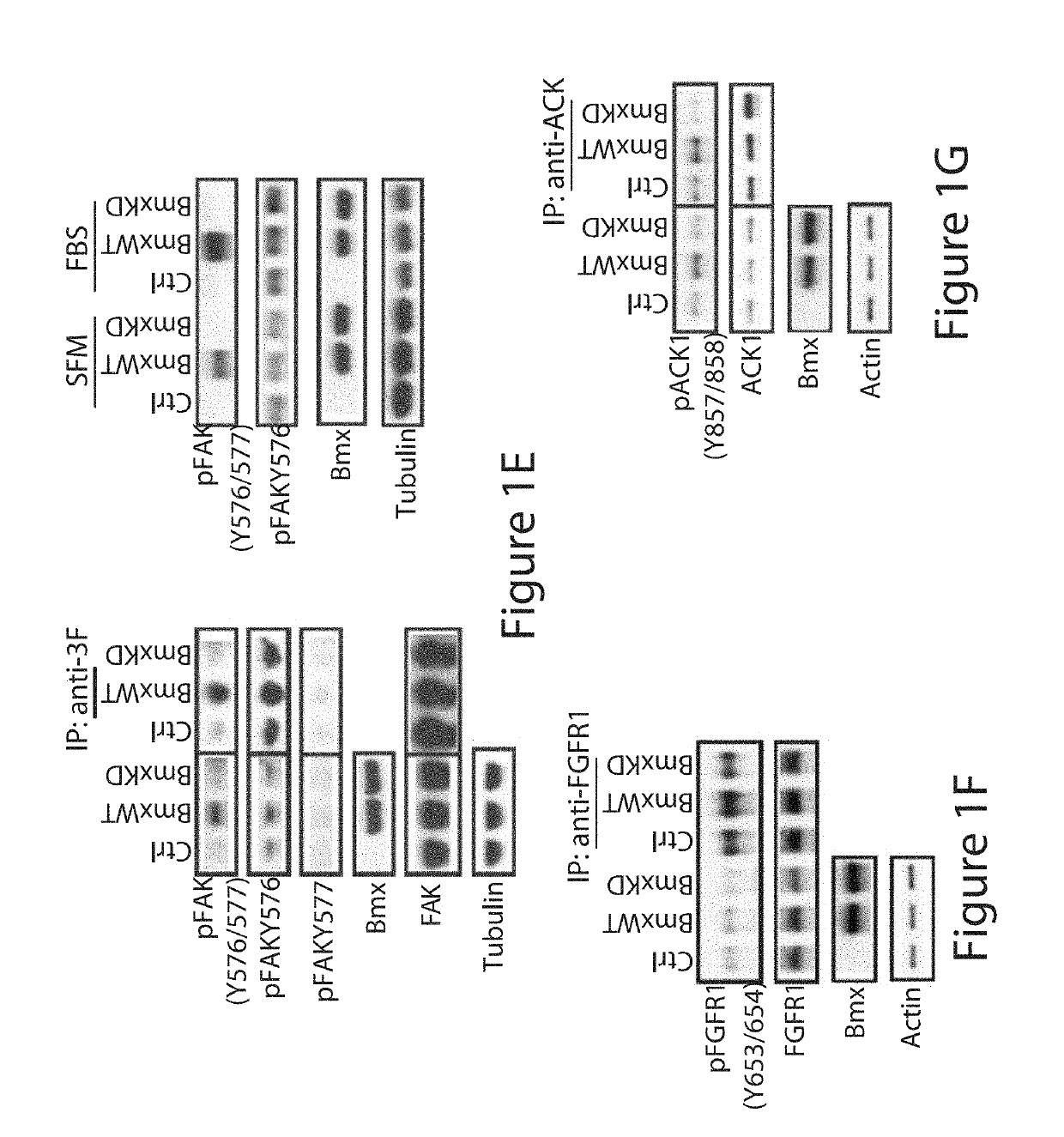 Bone marrow on x chromosome kinase (BMX) inhibitors and uses thereof