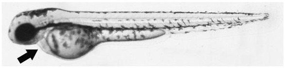 Dilated Cardiomyopathy Therapeutic Drugs and Its Application