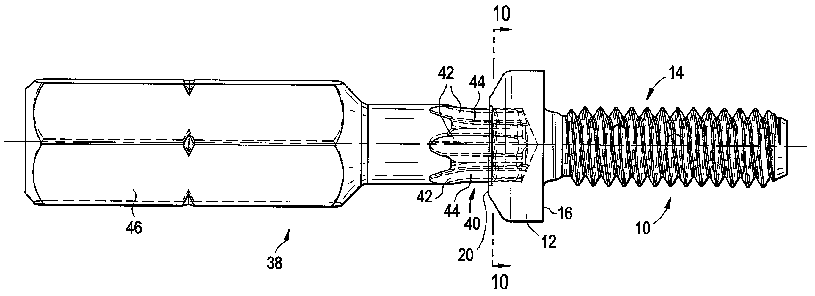 Lobular drive system with interference fit and method and apparatus for fabricating same