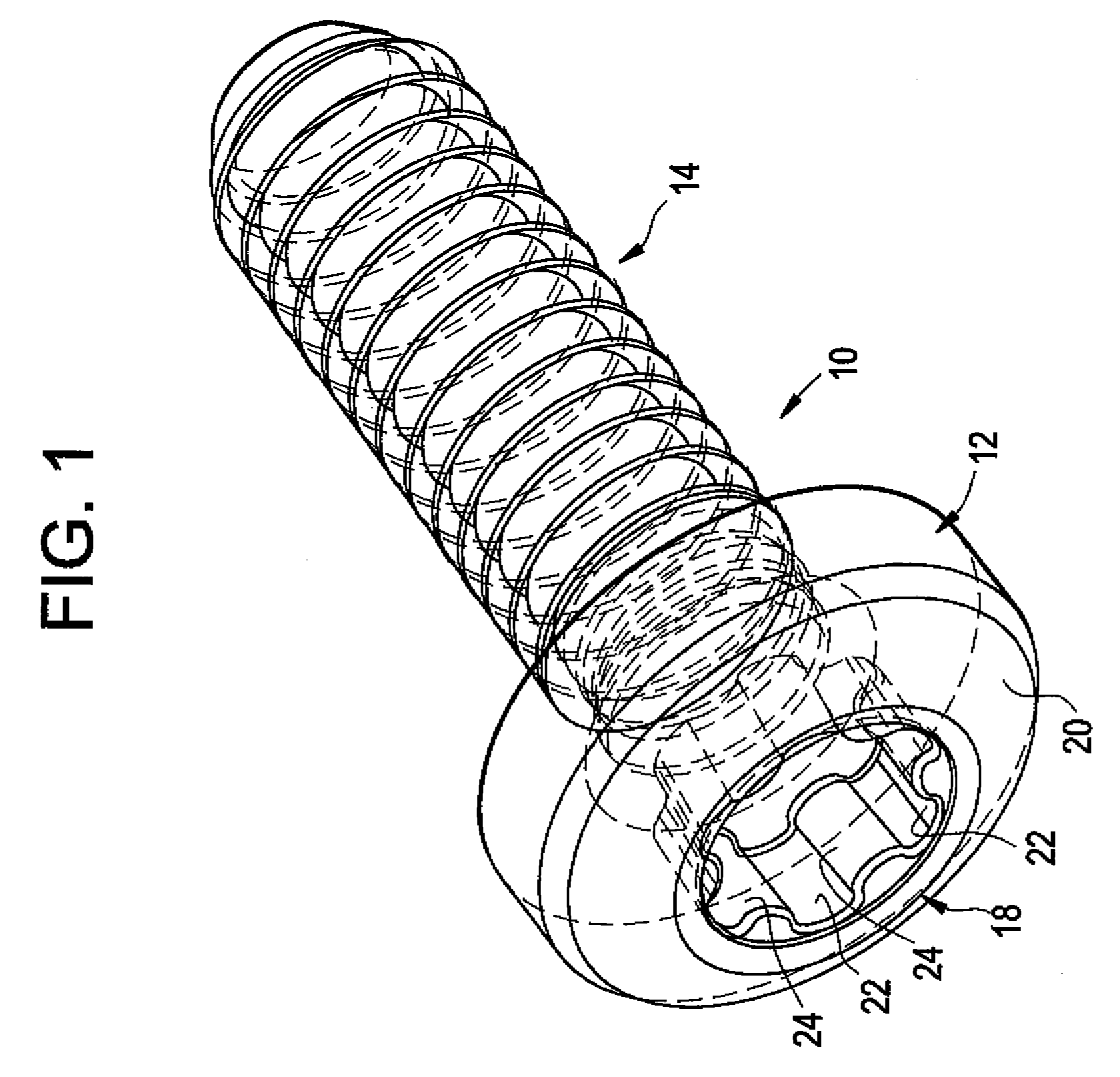 Lobular drive system with interference fit and method and apparatus for fabricating same