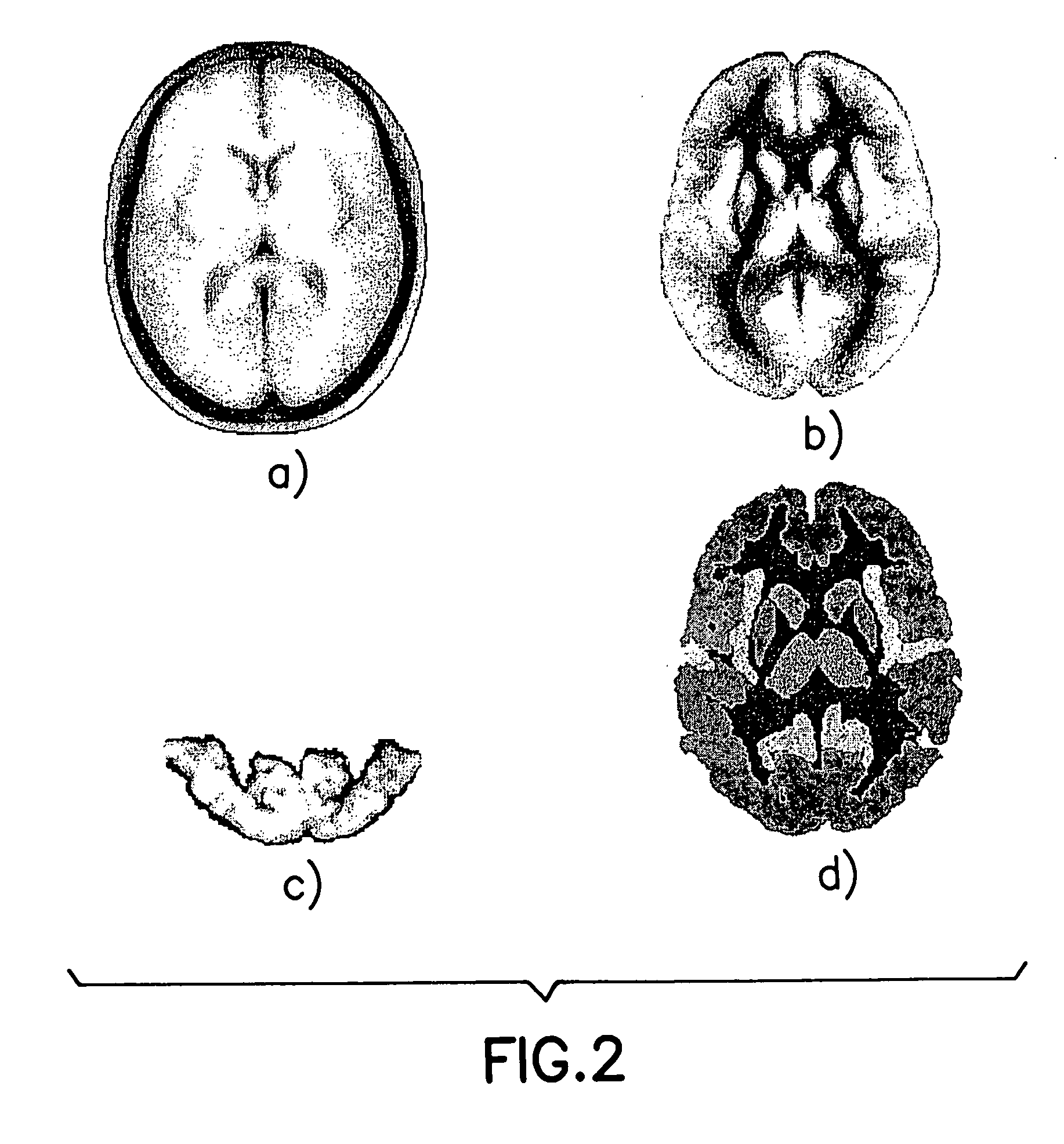 System and method for the tomography of the primary electric current of the brain and of the heart