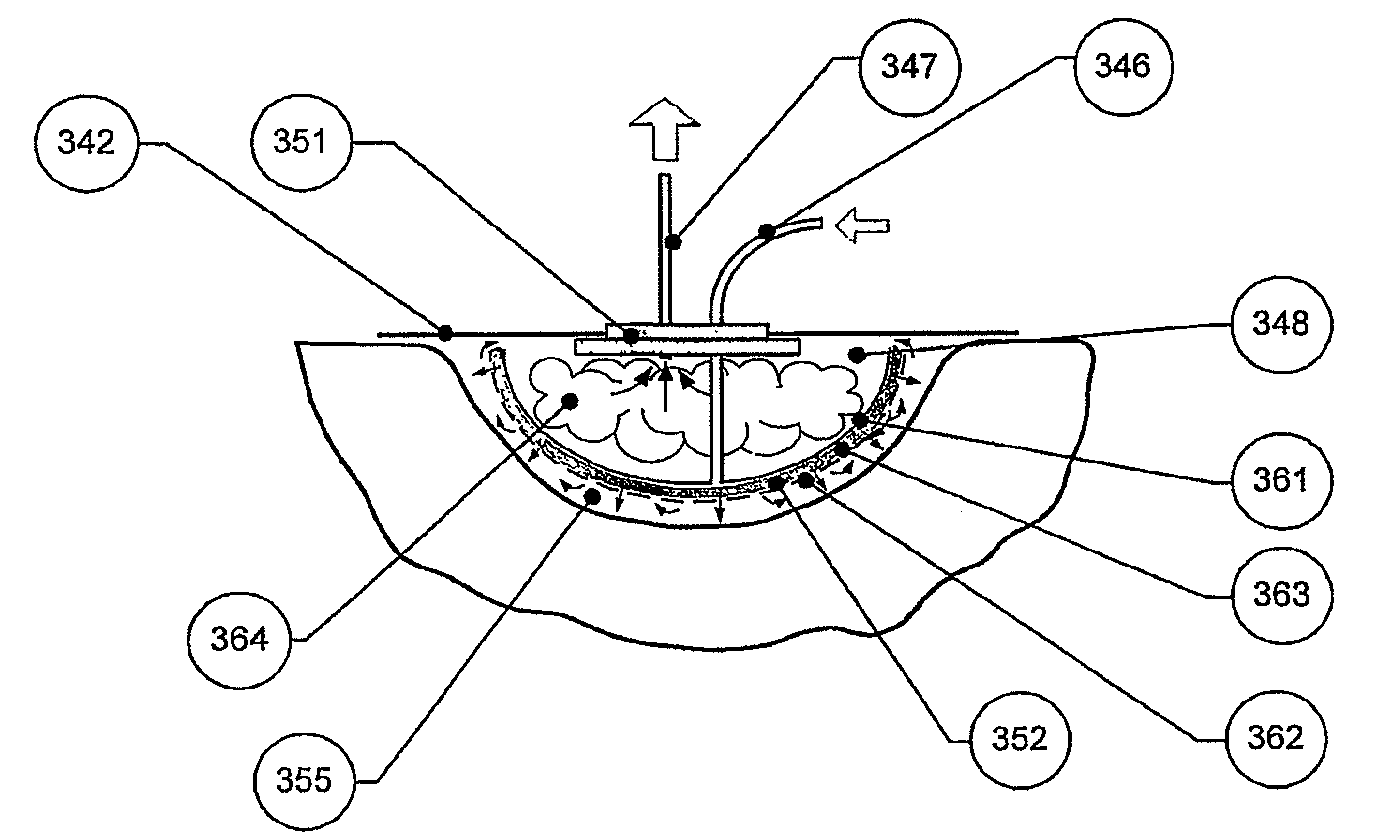 Apparatus for aspirating, irrigating and cleansing wounds