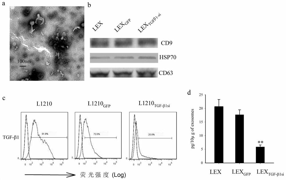 TGF-β1 silenced leukemia cell exosomes modified by interfering sequence and preparation method and application thereof