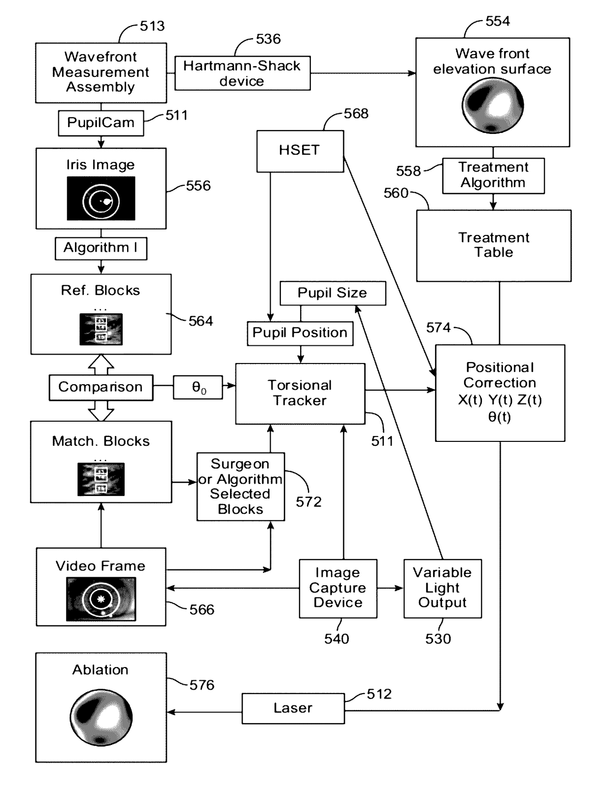 System and methods for mitigating changes in pupil size during laser refractive surgery to maintain ablation centration