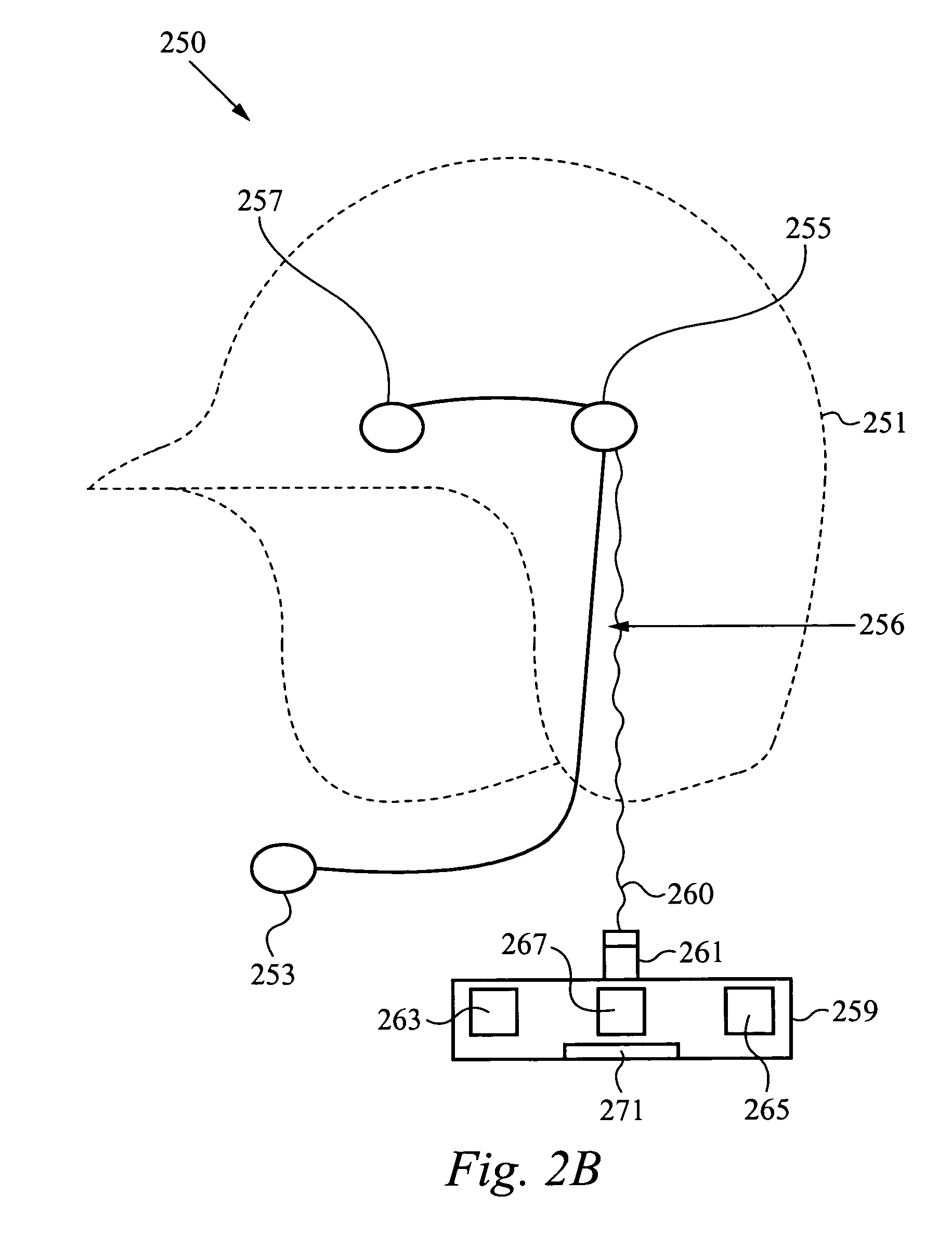 Bone conduction systems and methods