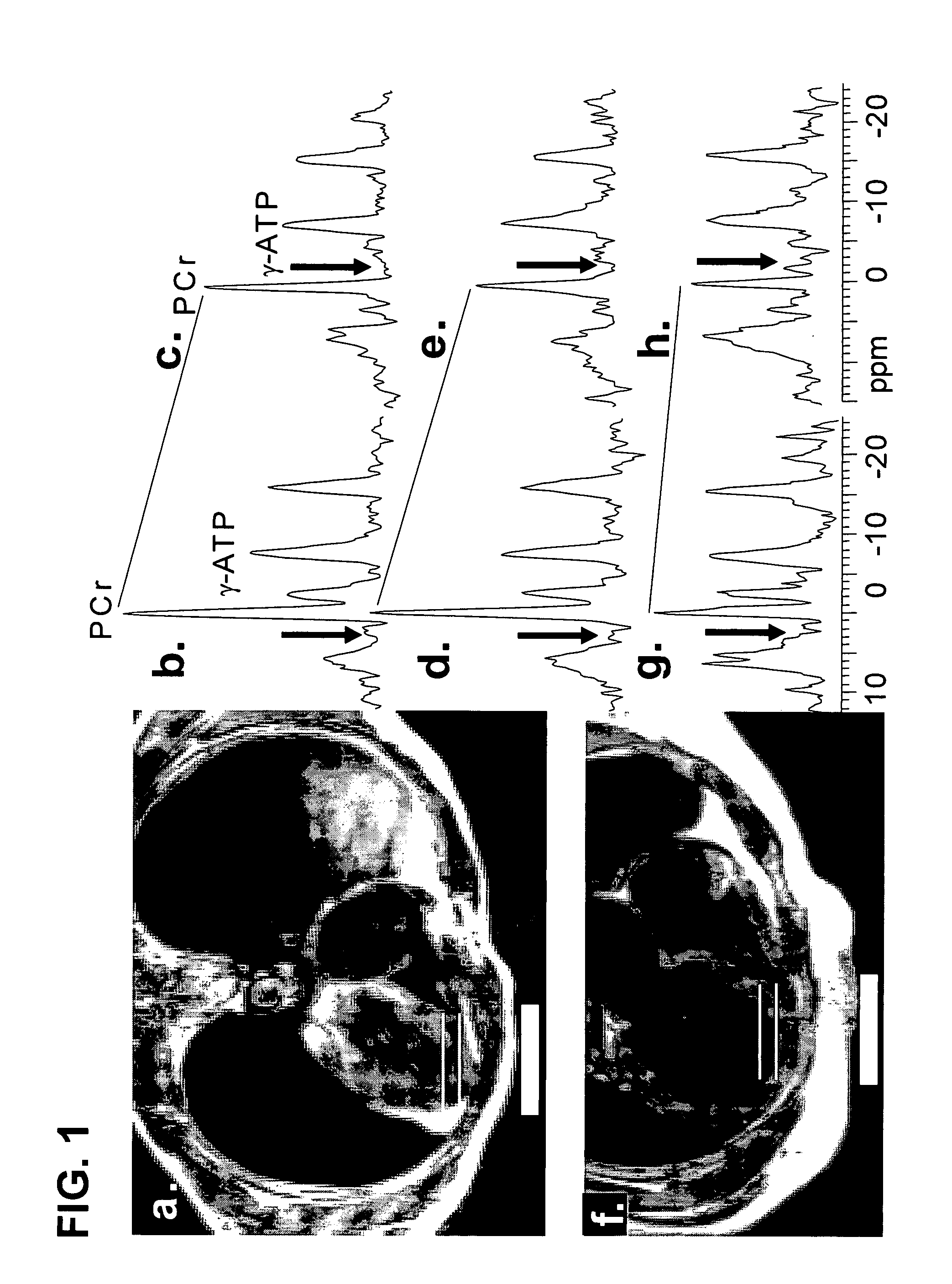 Methods to improve creatine kinase metabolism and contractile function in cardiac muscle for the treatment of heart failure