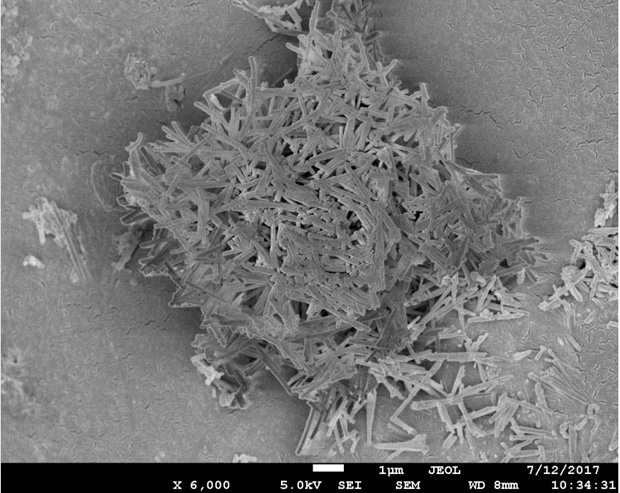 Carrier, catalyst and preparation method for hydrogenation protecting agent