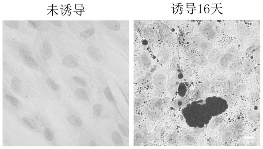 Method for inducing human skin fibroblasts to differentiate into adipocytes in vitro