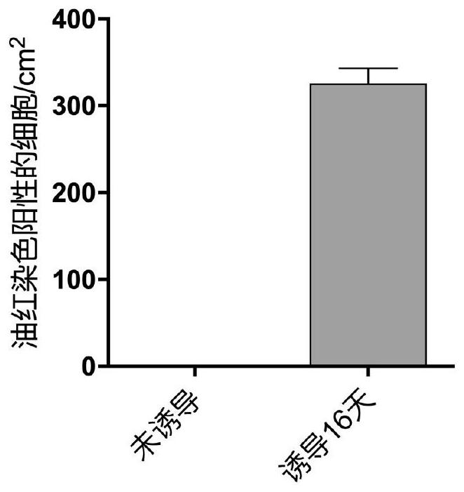 Method for inducing human skin fibroblasts to differentiate into adipocytes in vitro