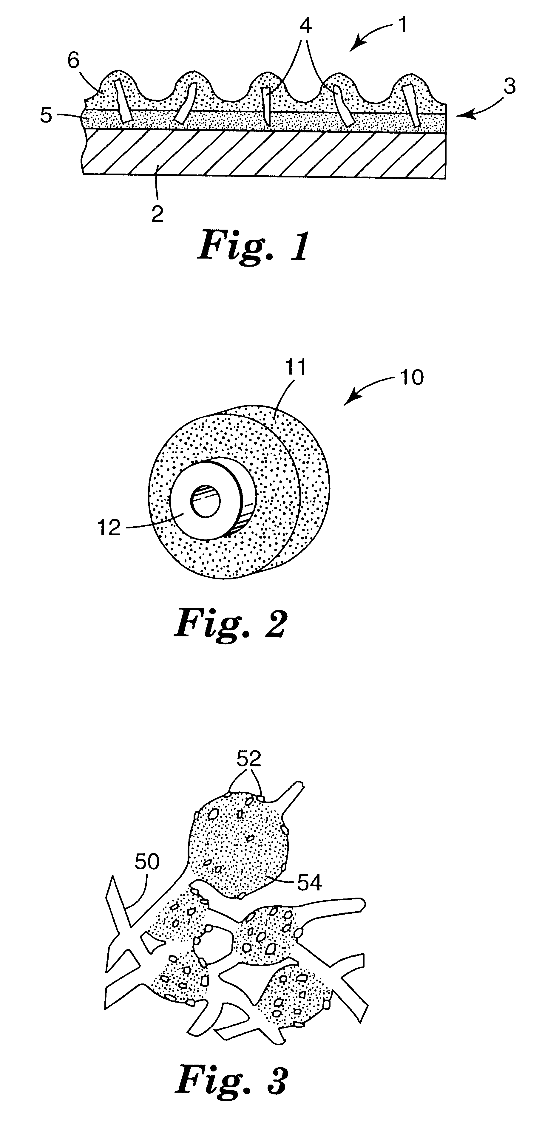Fused Al2O3-rare earth oxide eutectic abrasive particles, abrasive articles, and methods of making and using the same