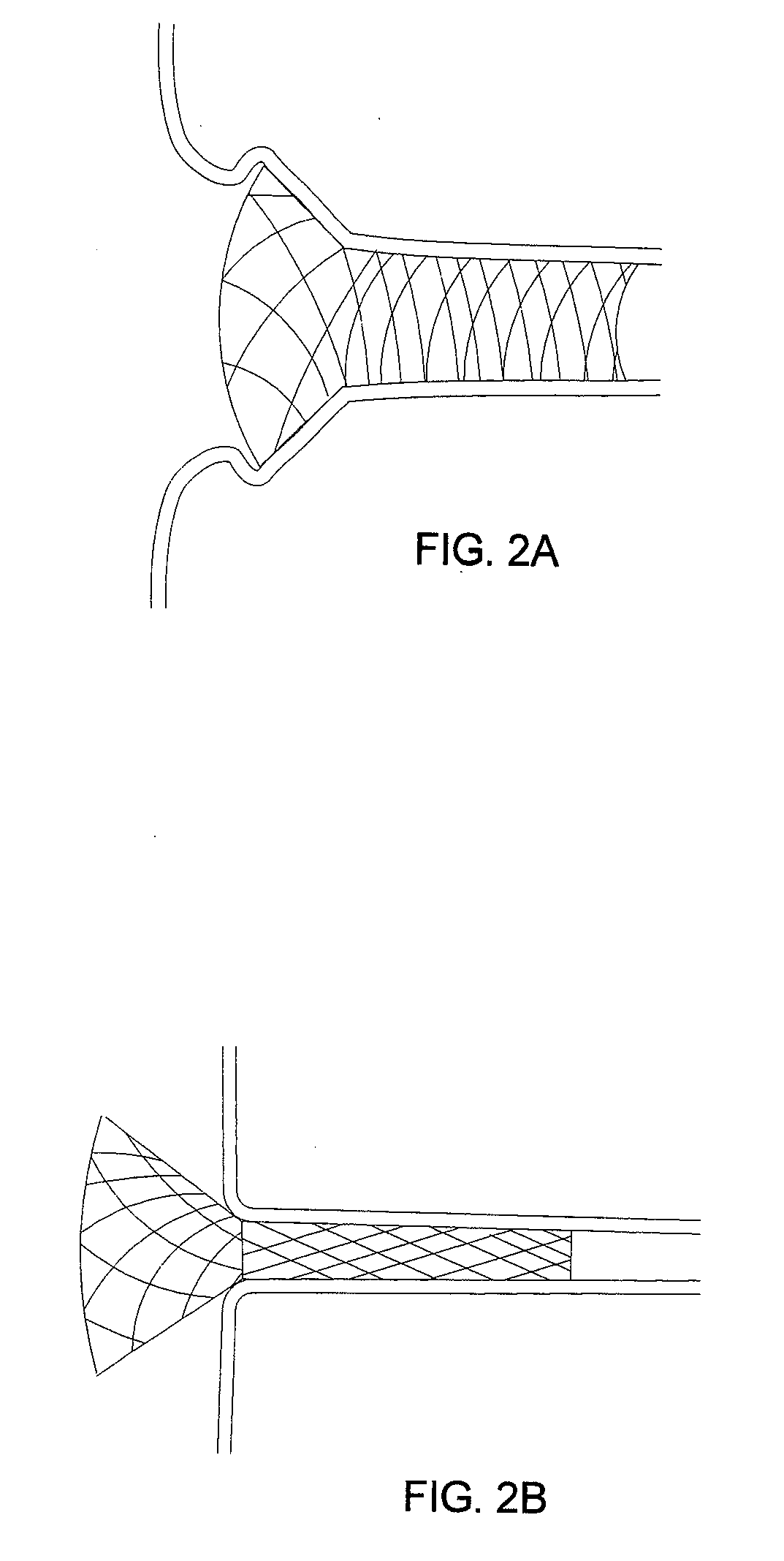 Steep-taper flared stents and apparatus and methods for delivering them