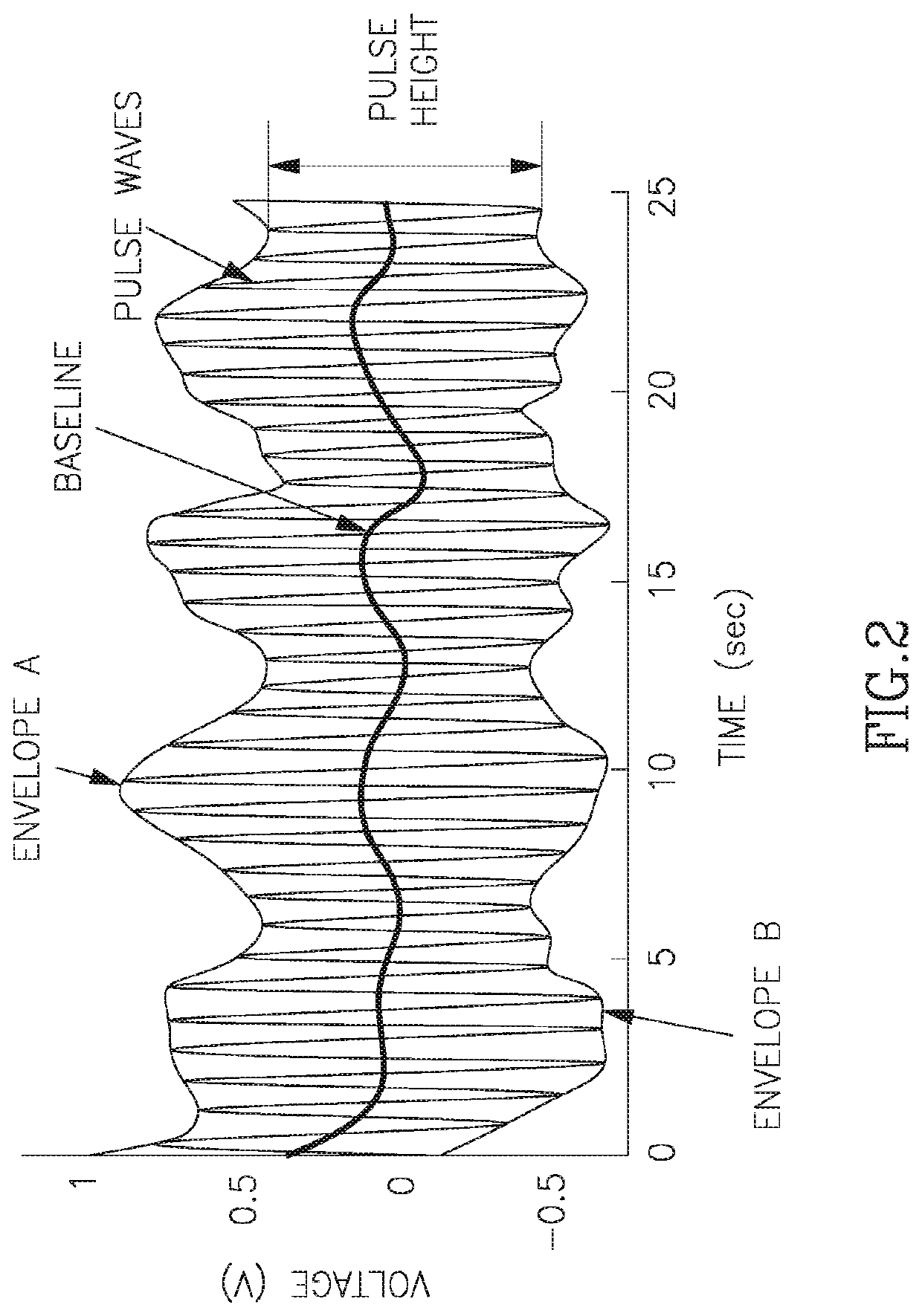Method and apparatus for non-invasive detection of physiological and patho-physiological sleep conditions