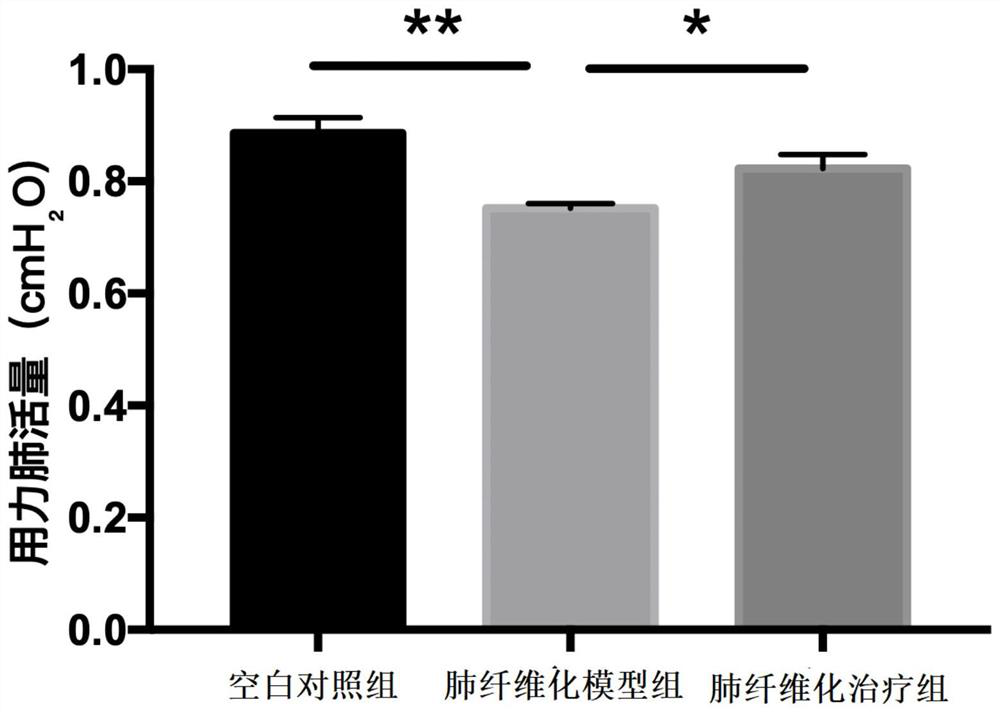 Application of darunavir in preparation of medicine for treating pulmonary fibrosis diseases