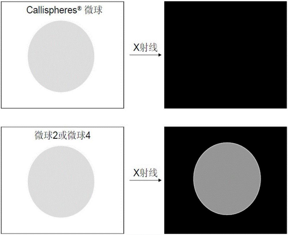 Developing embolism microsphere for treating tumor diseases through minimally invasive interventional therapy and preparation method thereof