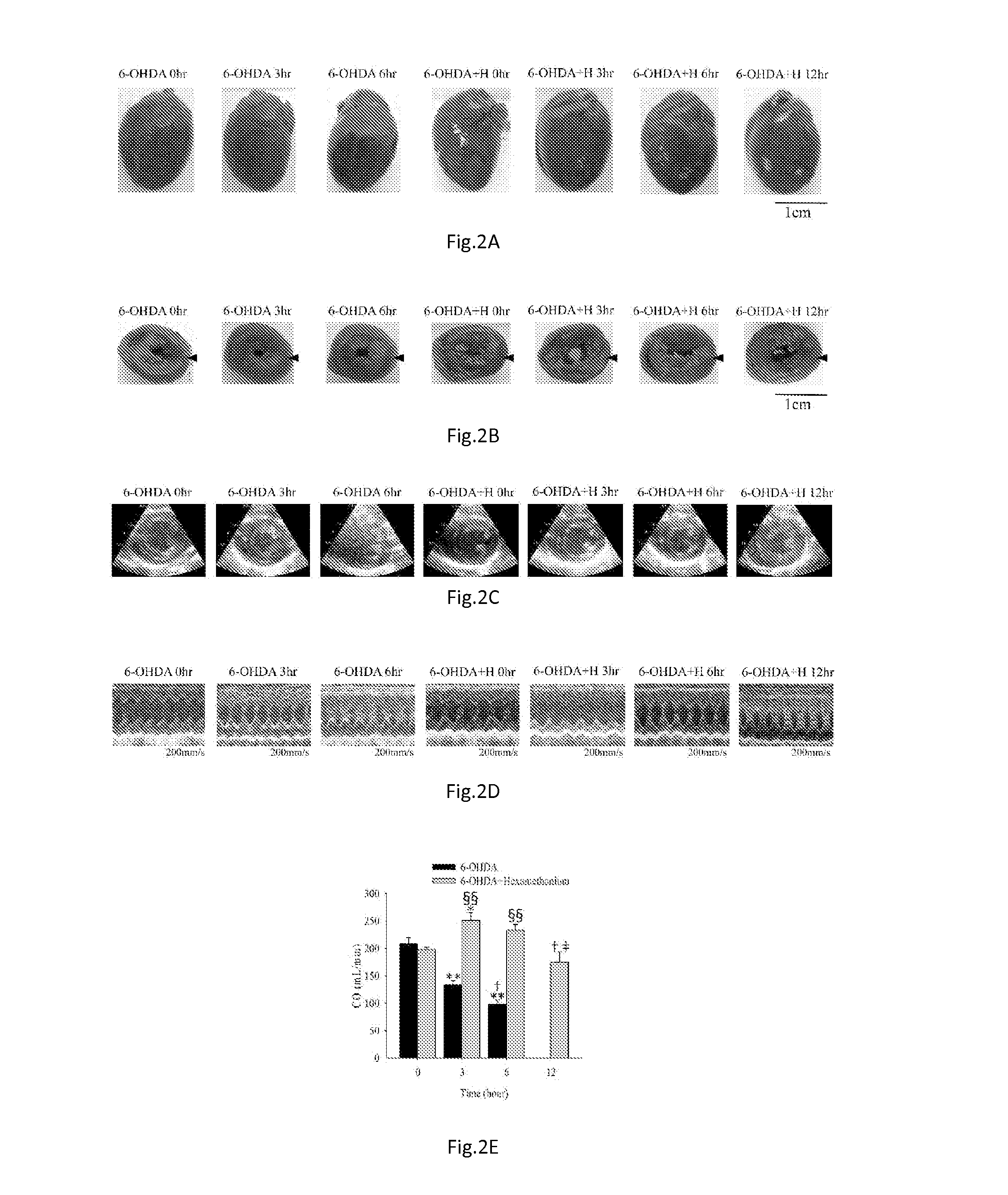 Hexamethonium Reverses the Lethal Cardiopulmonary Damages in a Rat Model of Brain Stem Lesions Mimicking Fatal Enterovirus 71 Encephalitis