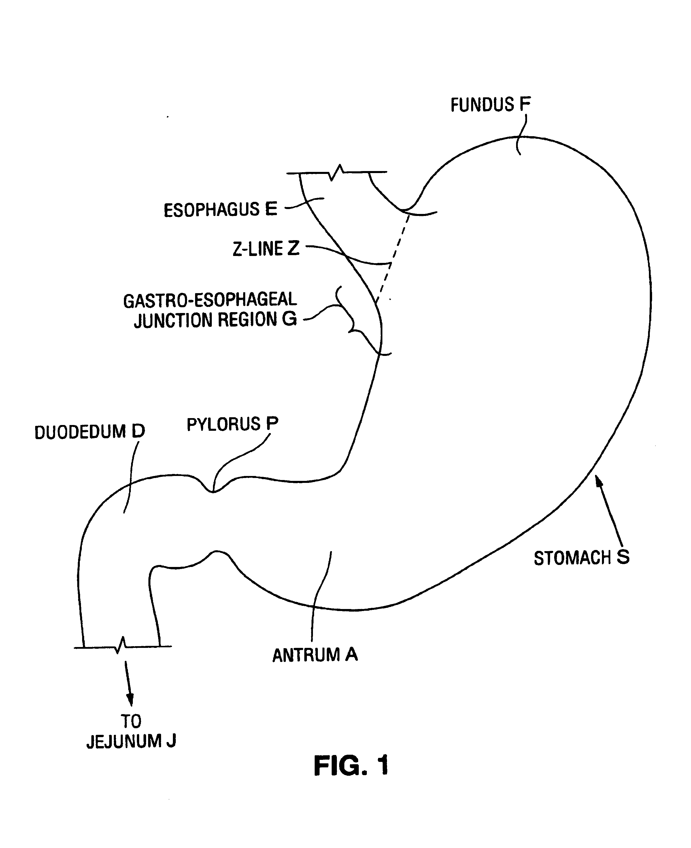Satiation devices and methods