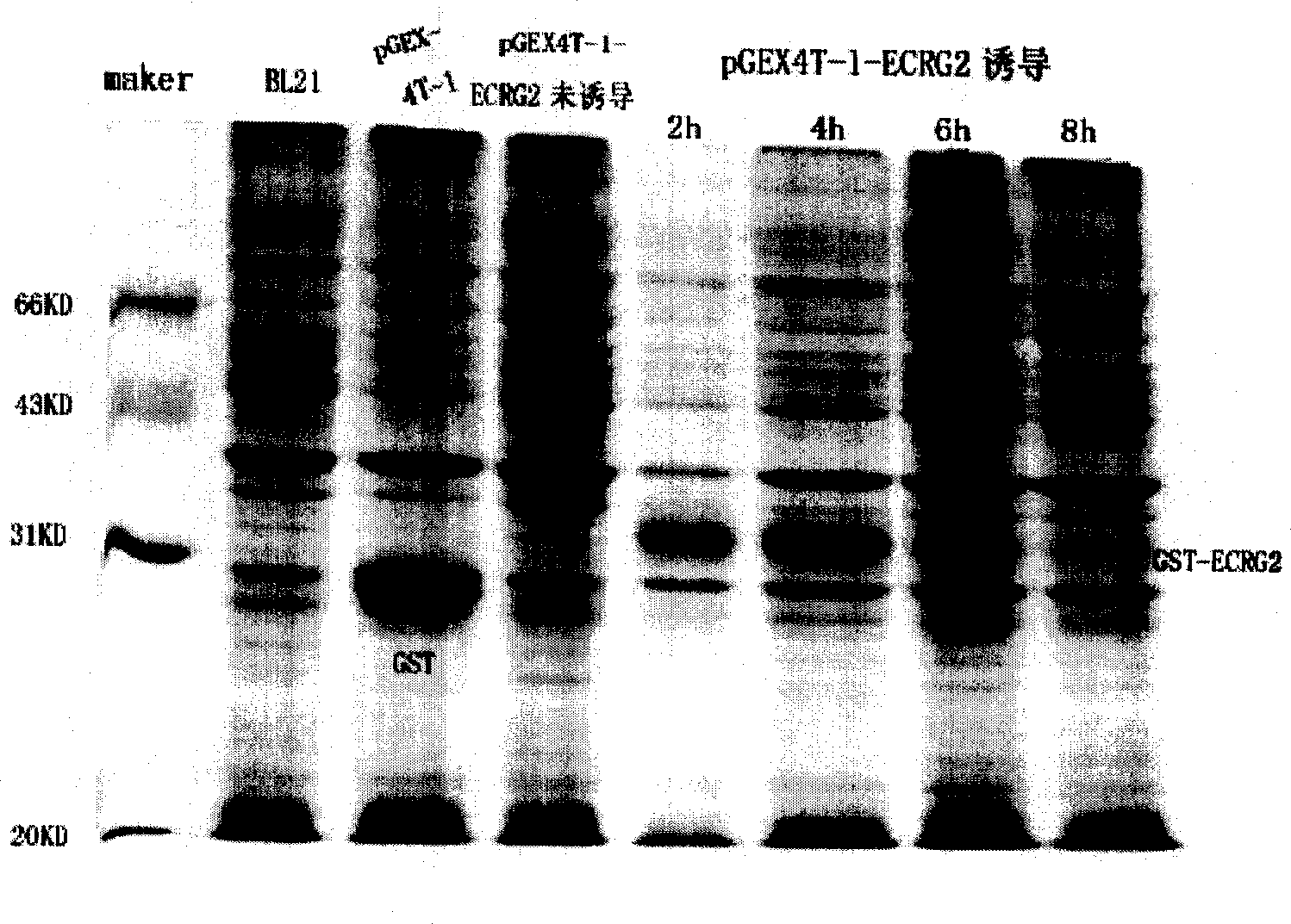 Carcinoma of esophagus related gene-2 and use of coding protein thereof