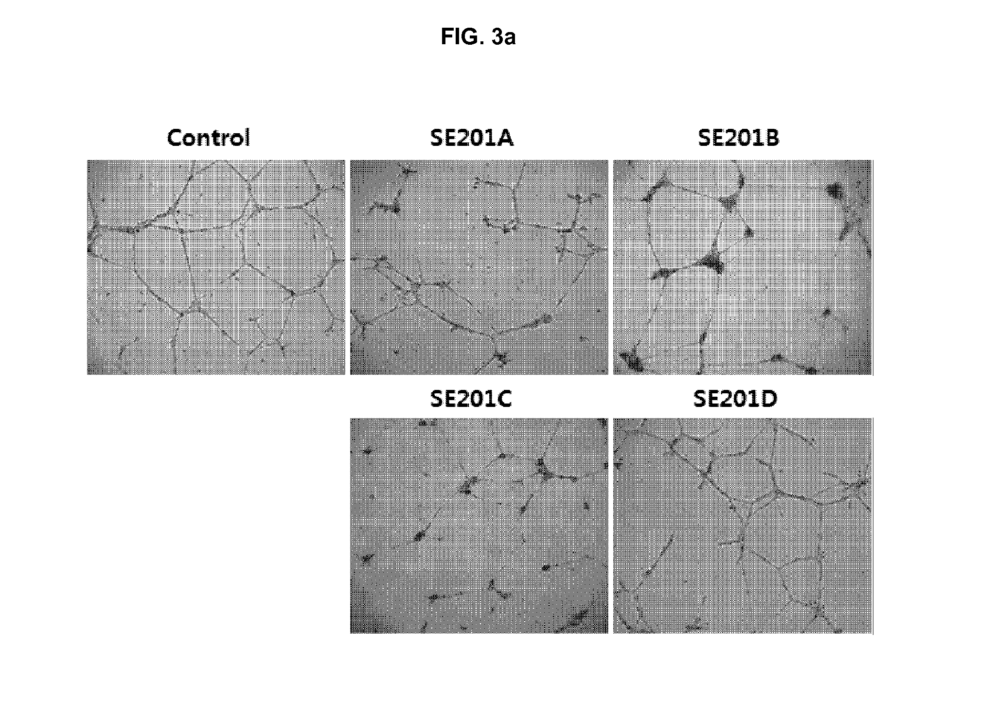 Peptides having nf-kb inhibitory activity, or composition comprising same