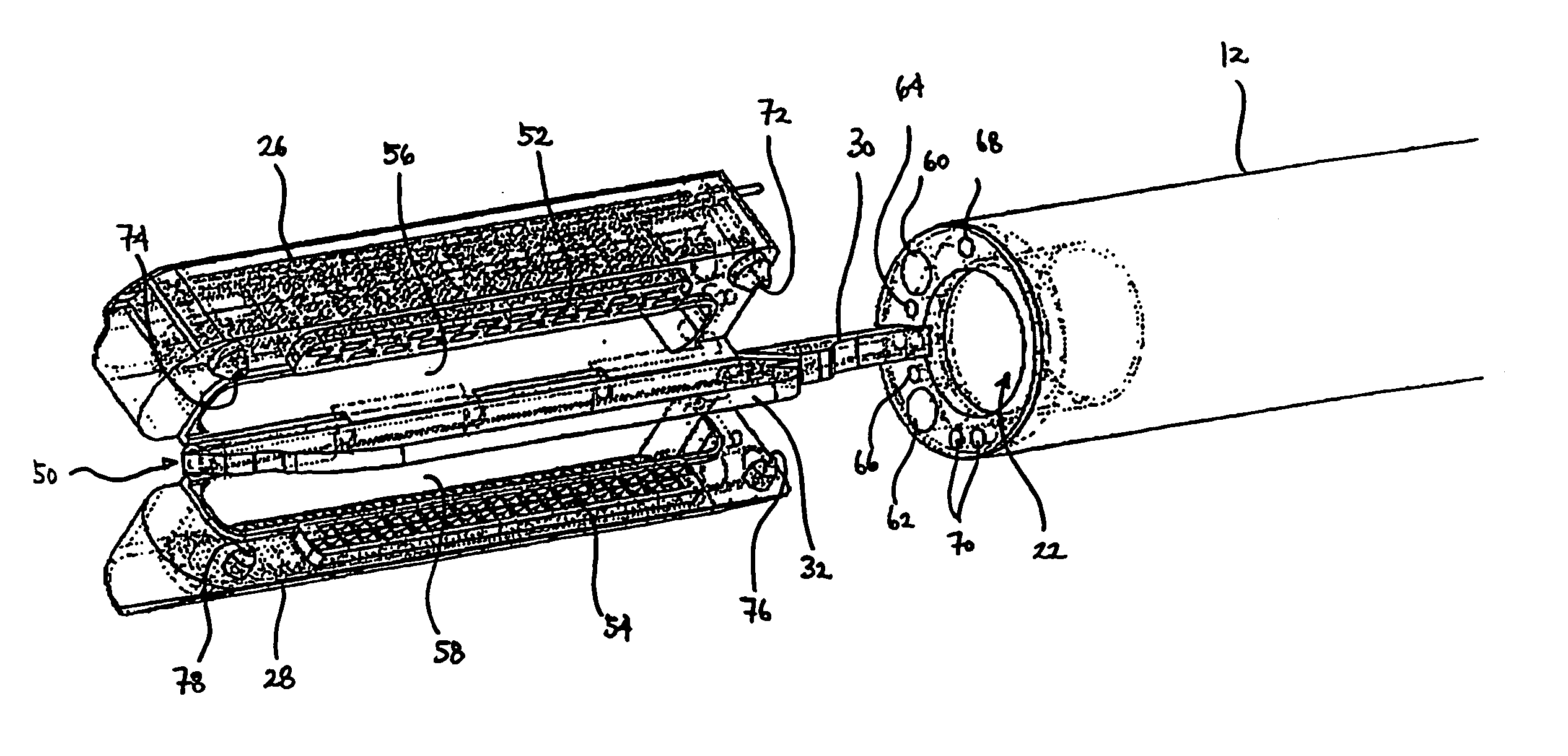Devices and methods for placement of partitions within a hollow body organ