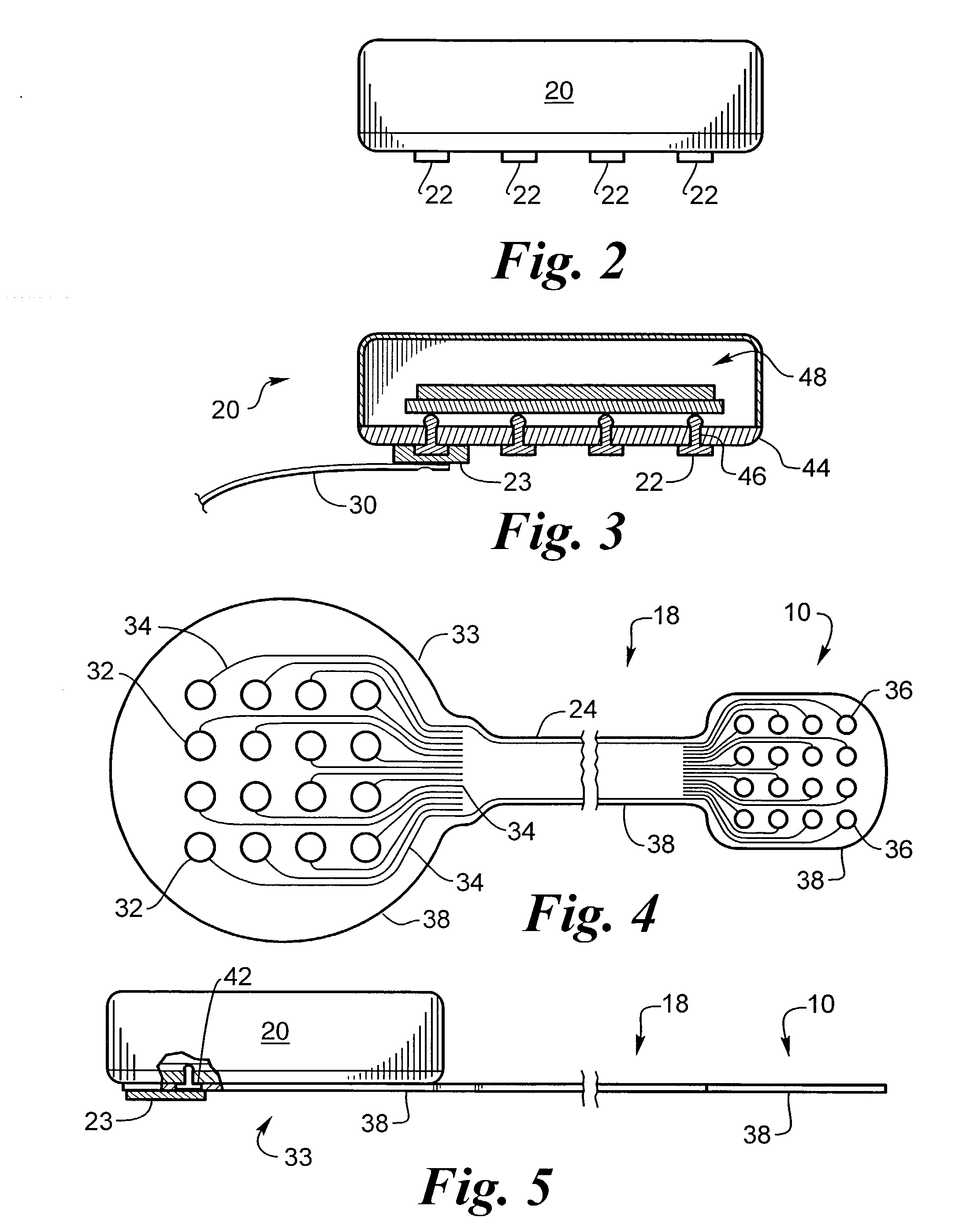 Biocompatible bonding method and electronics package suitable for implantation
