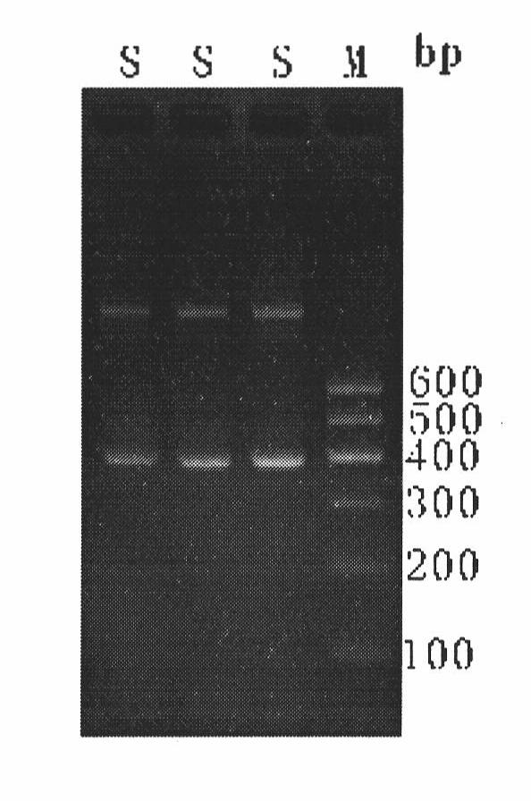 Rana chensinensis functional gene Rd-RNase3 sequence, construction method and amino acid sequence and application thereof