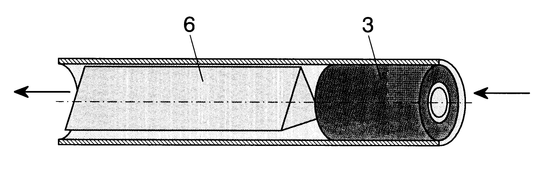 External magnetic actuation valve for intraurethral artificial urinary sphincter