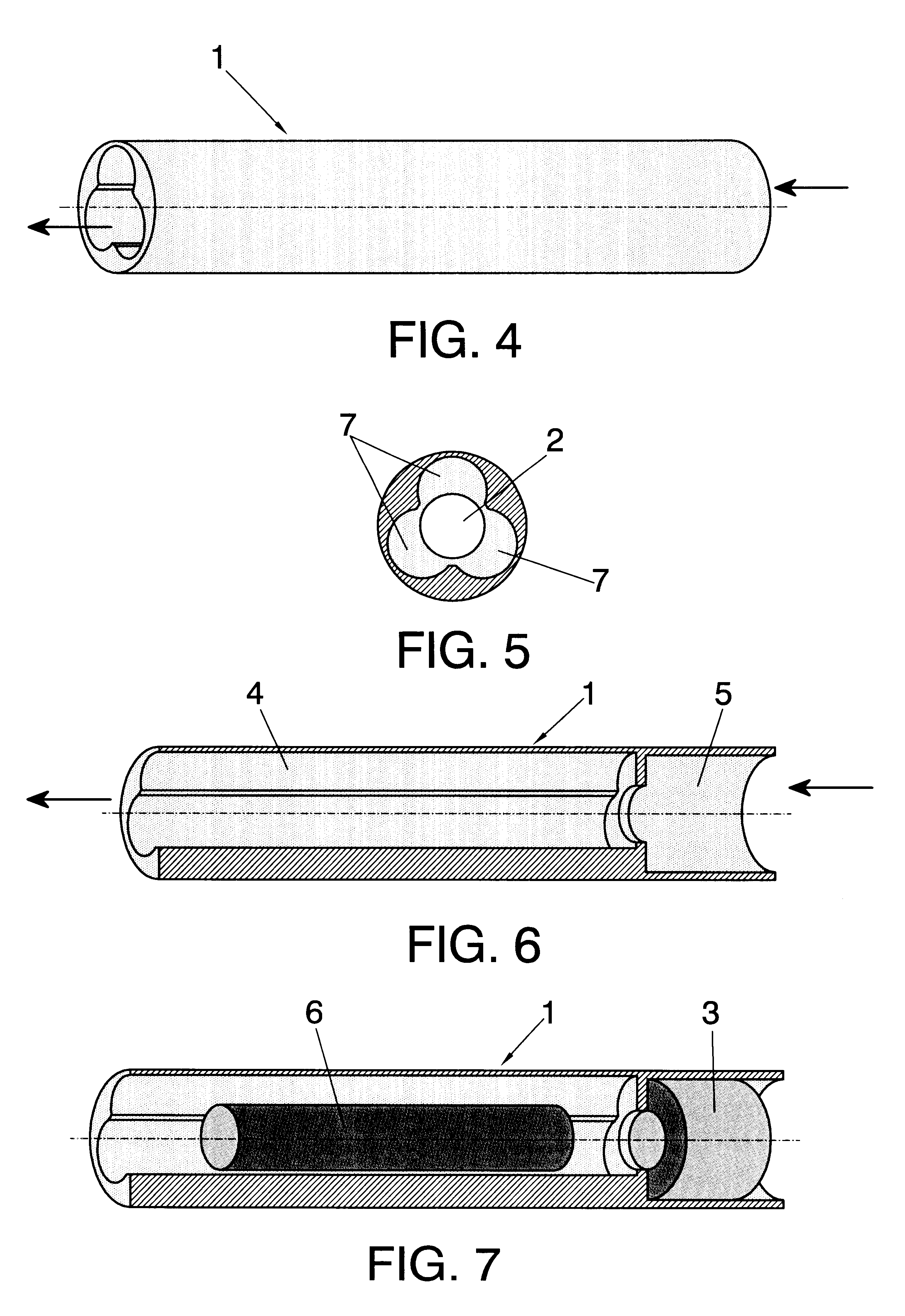 External magnetic actuation valve for intraurethral artificial urinary sphincter